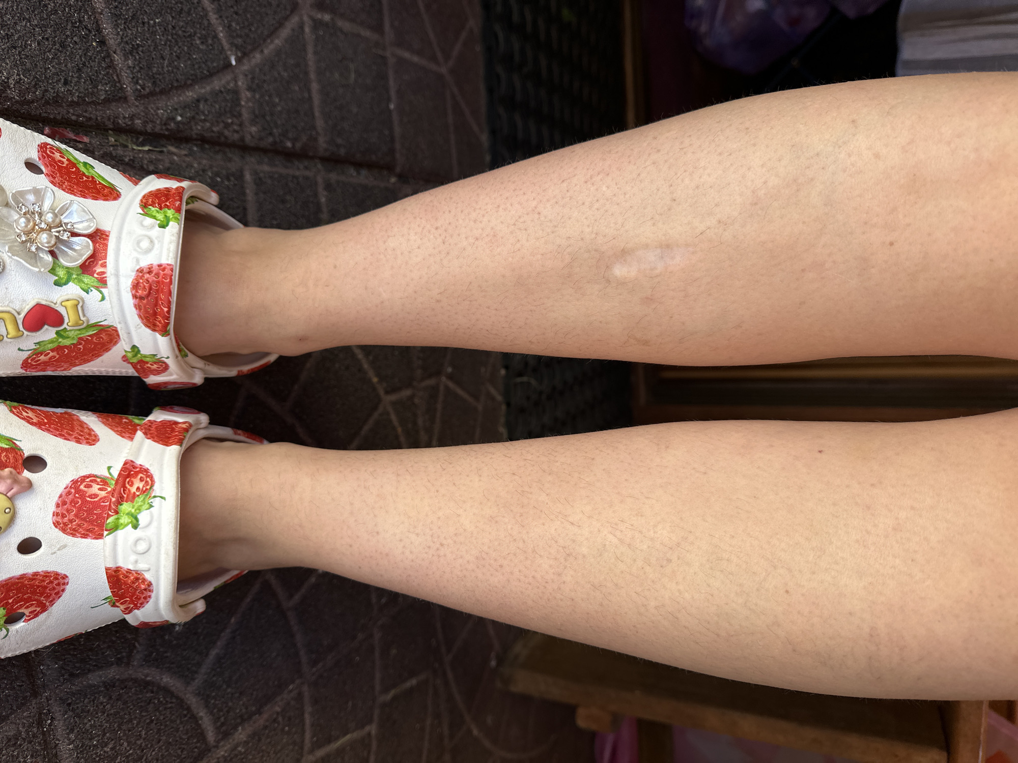 The image displays a person's lower legs and feet, seen from a high-angle, top-down perspective. The subject is wearing a pair of white Crocs-style sandals adorned with a repeating pattern of red strawberries and green leaves. The right sandal features an elaborate, multi-layered decorative charm resembling a flower, embellished with pearls and clear rhinestones. A small, yellow character-like charm is visible on the left sandal.
Both bare legs are visible, showing fine, light-colored body hair. A distinct, light-colored, slightly raised scar is present on the upper calf of the right leg. The feet are inserted into the sandals, indicating the person is wearing them.
The setting appears to be outdoors or in a semi-outdoor area, with a dark, textured ground surface, possibly made of stone or patterned tiles, forming the background. Some dark, blurry shapes are visible in the deeper background, suggesting shadows or distant objects.
No specific activity beyond wearing the sandals is clearly depicted. The lighting suggests it is daytime. The word "I" is partially visible on the right sandal, likely part of a phrase like "I love strawberries." The provided context indicates the location is Nizhny Novgorod, Russia.