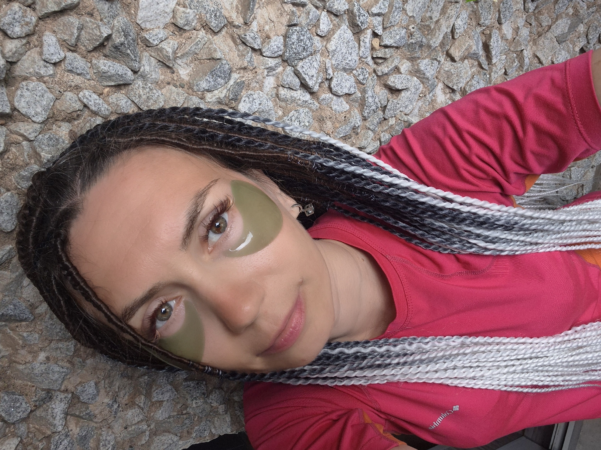 A young woman with braided hair and eye patches is pictured from the chest up, in front of a stone wall. The woman has medium-length brown hair, braided into numerous thin strands that are partially white. She is wearing a pink t-shirt and has green eye patches on. The background is a wall constructed of various sizes of gray stones. The image is taken from a slightly elevated angle, looking down at the woman.