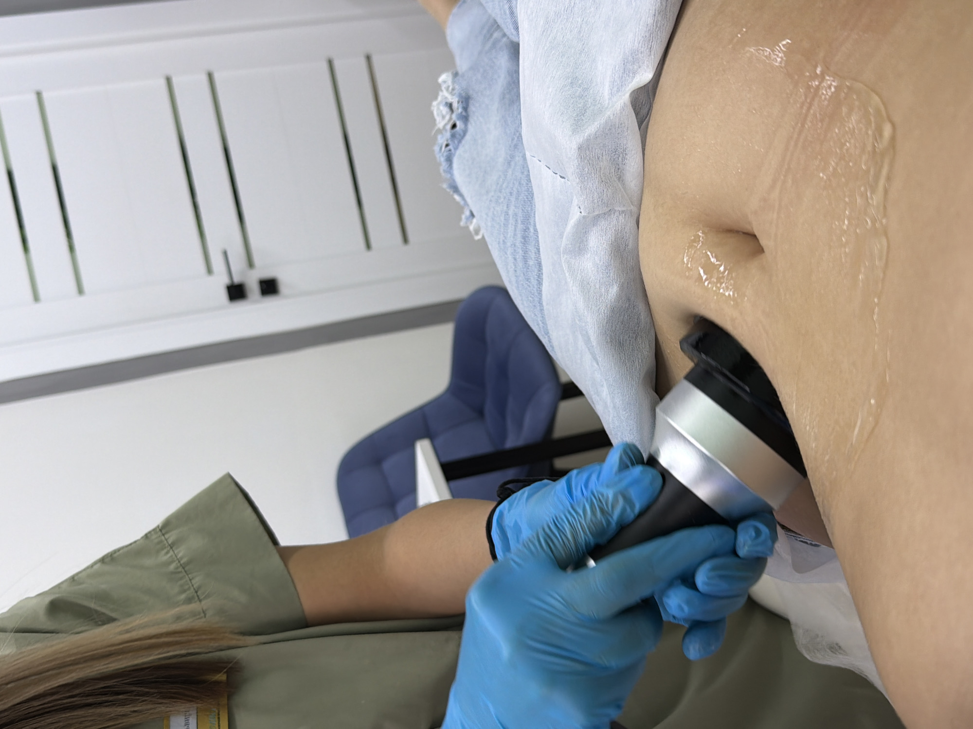 This image captures an indoor scene, likely a medical or cosmetic treatment room, focusing on a procedure being performed on a person's abdomen. The patient's midsection is prominently featured, lying down, with their bare abdomen coated in a clear, viscous gel. They are wearing light blue ripped jeans, partially covered by a white disposable sheet or garment.
In the foreground and lower left, a practitioner's arm and hand are visible, encased in bright blue surgical gloves, holding a silver and black handheld treatment device. This device is pressed against the patient's abdomen, indicating an active procedure. Part of the practitioner's olive green uniform or scrub top is seen, along with a glimpse of their long brown hair. A yellow tag or badge on their uniform has faint, illegible text.
The background shows elements of a professional environment. A dark blue, padded office-style chair is partially visible. Above it, white cabinets or shelves with vertical lines and small black handles adorn the wall, suggesting storage facilities typical of a clinic or salon. The overall setting appears clean and functional, consistent with a medical or aesthetic practice. The presence of the specialized device and gel suggests a non-invasive treatment such as ultrasound, radiofrequency therapy, or cavitation, taking place in Chaikovsky, Russia.