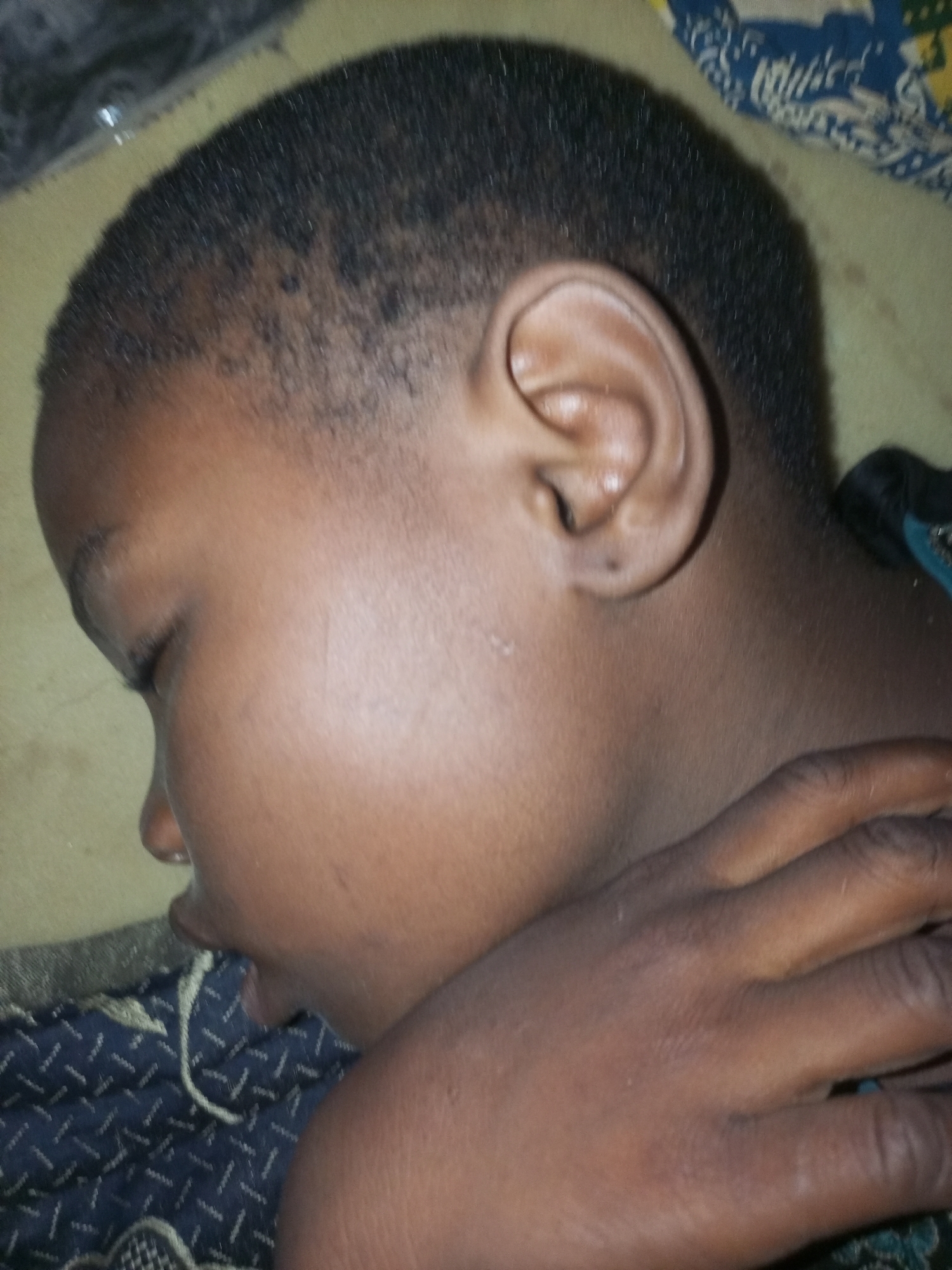 The image is a close-up, profile view of a child's face, specifically the right side, with the child lying down. The child has dark skin and short, dark hair that is faded on the sides. The child's right eye is closed, and their mouth is slightly open. The child's right ear is visible and appears to have a small dark mark on it. A hand, also with dark skin, is resting on the child's cheek and chin. The background consists of a patterned fabric and a light-colored surface, possibly a pillow or mattress. The lighting suggests an indoor setting. There are no contextual elements that place the scene in a specific city or location.