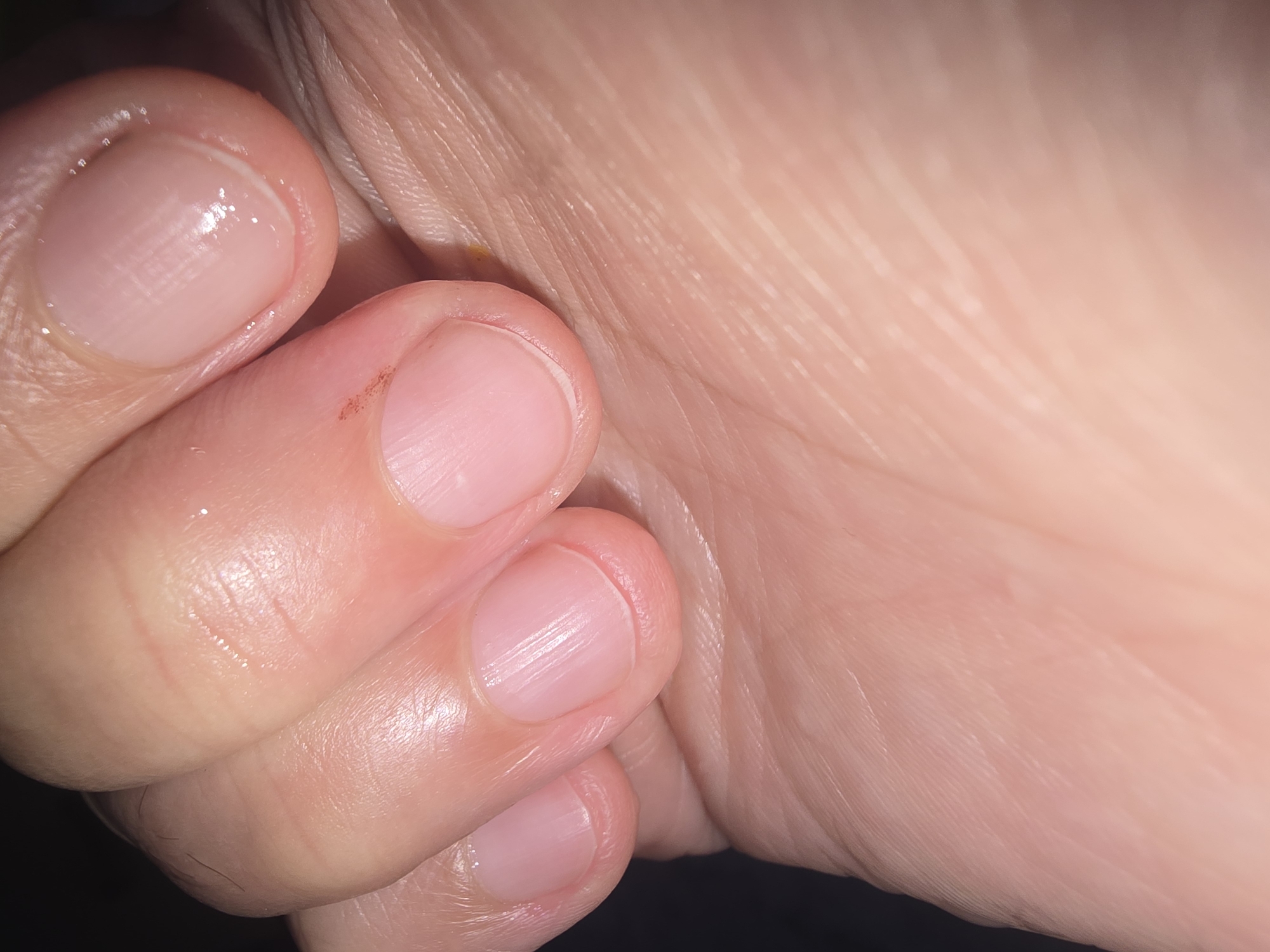 A close-up, dimly lit, vertical, slightly angled shot shows the palm and fingers of a person's hand. The skin is a light tone and appears smooth with visible lines and pores on the palm. The nails of four fingers are visible, appearing short and rounded, with a light pinkish hue. One finger shows a small dark spot or blemish on the cuticle. The lighting creates some shine and highlights on the skin and nails. The background is dark and out of focus, suggesting a low-light environment. This image is not representative of any specific location in Ulan-Ude, Russia, as it focuses solely on a close-up of a hand.