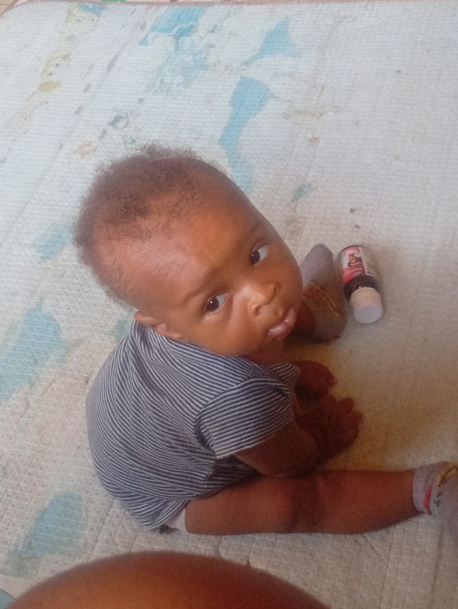 A brown-skinned baby is sitting on a patterned playmat. The baby is wearing a striped shirt and gray socks. Next to the baby is a small bottle of liquid medication. The environment appears to be indoors. There is no information in the image to confirm that this image was taken in Sabon Tasha, Nigeria.