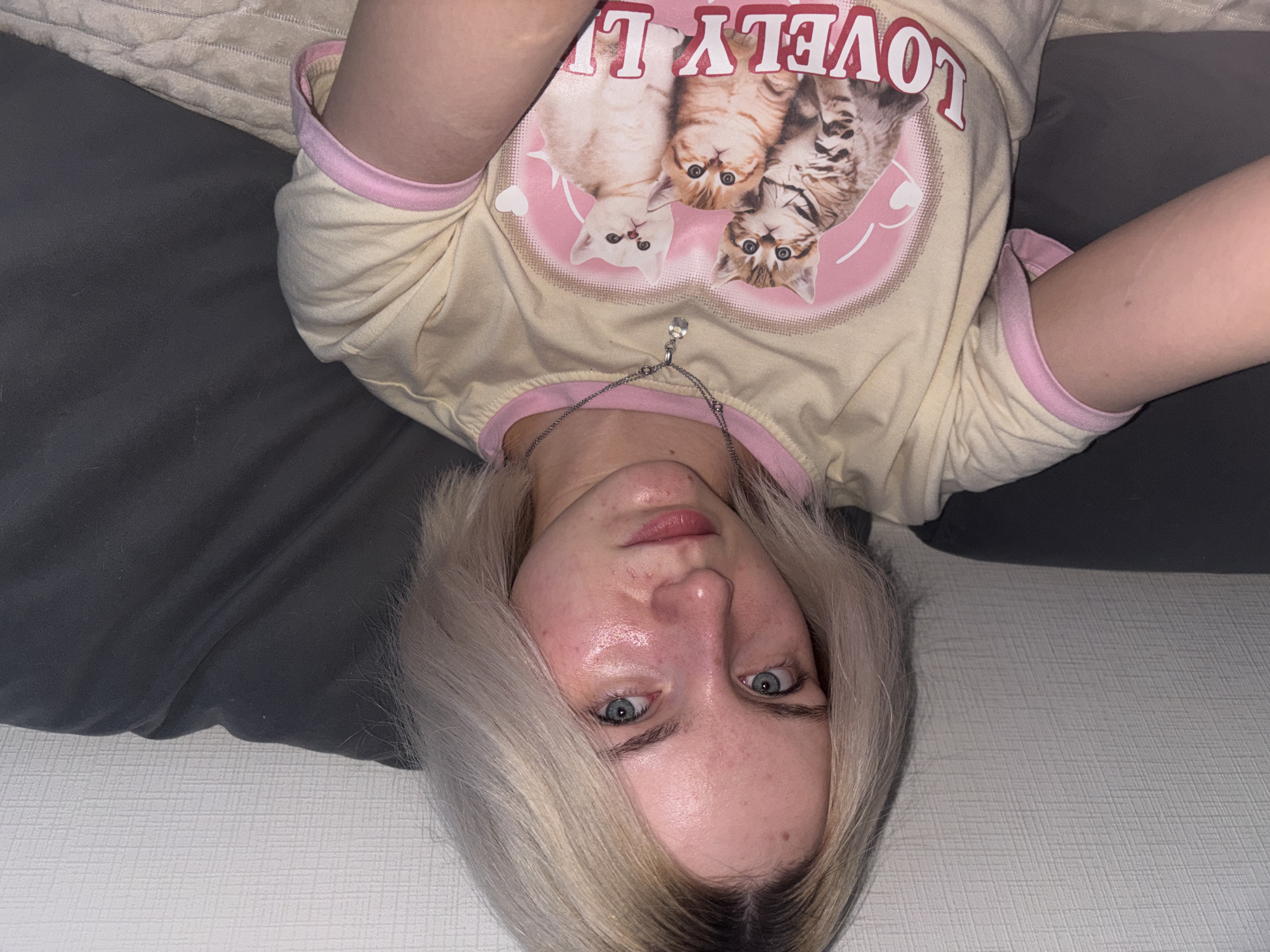 A young woman with light blonde hair and blue eyes lies on a grey and white textured surface. She is wearing a light yellow t-shirt with pink trim and a cartoon graphic of three cats. She is also wearing a necklace with a small charm. Her face shows some redness, possibly due to skin irritation. The setting is indoors, and it's difficult to pinpoint a specific location in Vsevolozhsk, Russia without additional context.