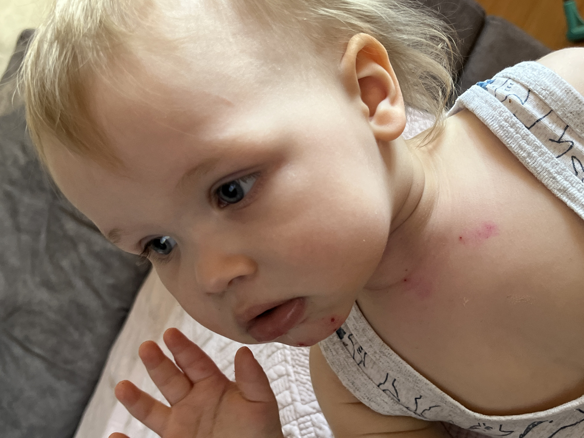 A close-up image depicts a fair-skinned toddler with blonde hair and blue eyes. The child is wearing a white tank top with a pattern. There are what appear to be minor skin abrasions or blemishes on the child's chest and near the mouth. The child is looking down and to the left, with an open hand visible in the foreground. The background includes a neutral-colored couch or upholstered surface. There is no indication of a location in Chaikovsky, Russia.