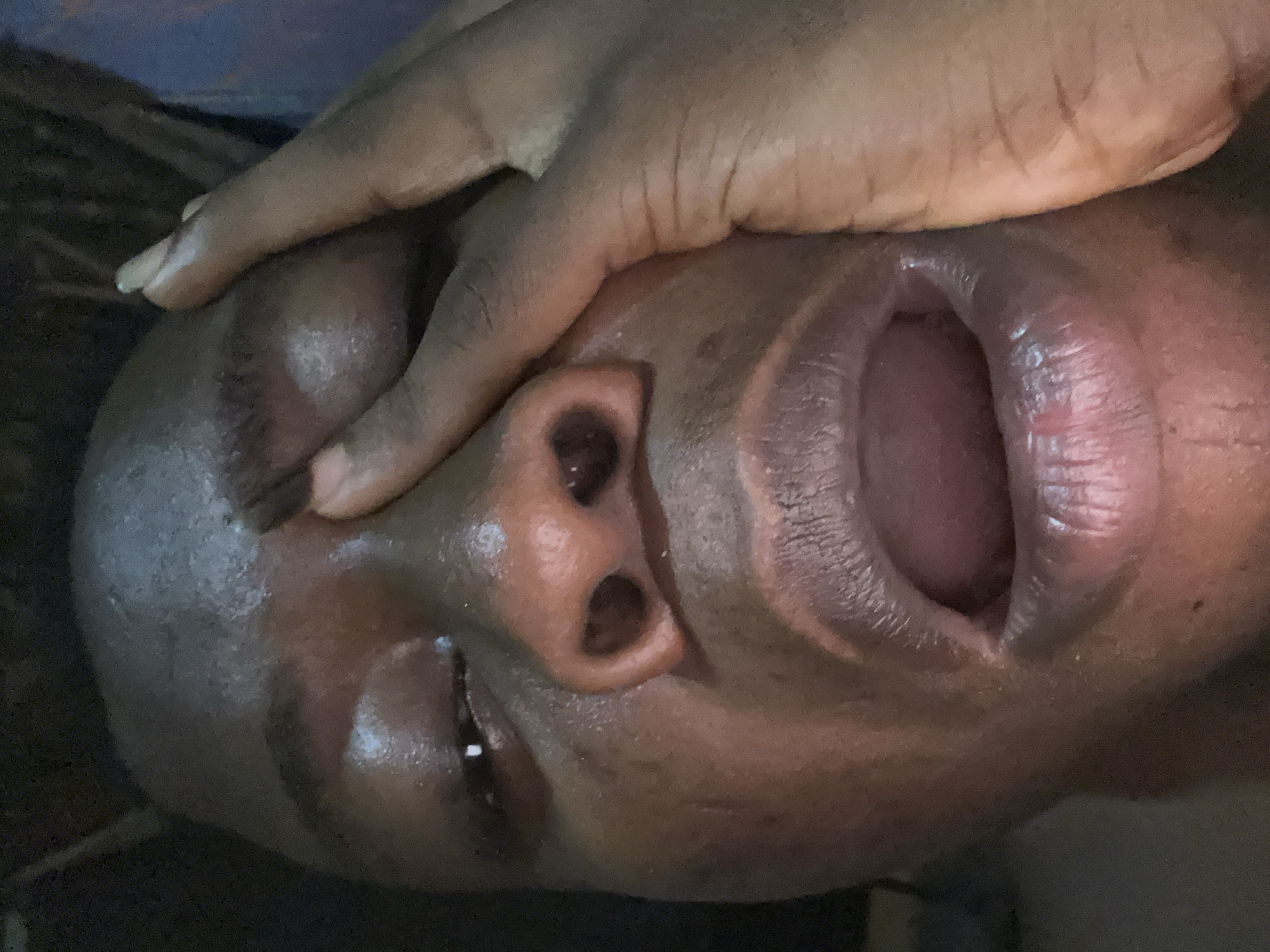A close-up, slightly tilted view of a dark-skinned person's face. A hand partially covers the forehead and eyes. The mouth is open. The location is not discernible from the image.