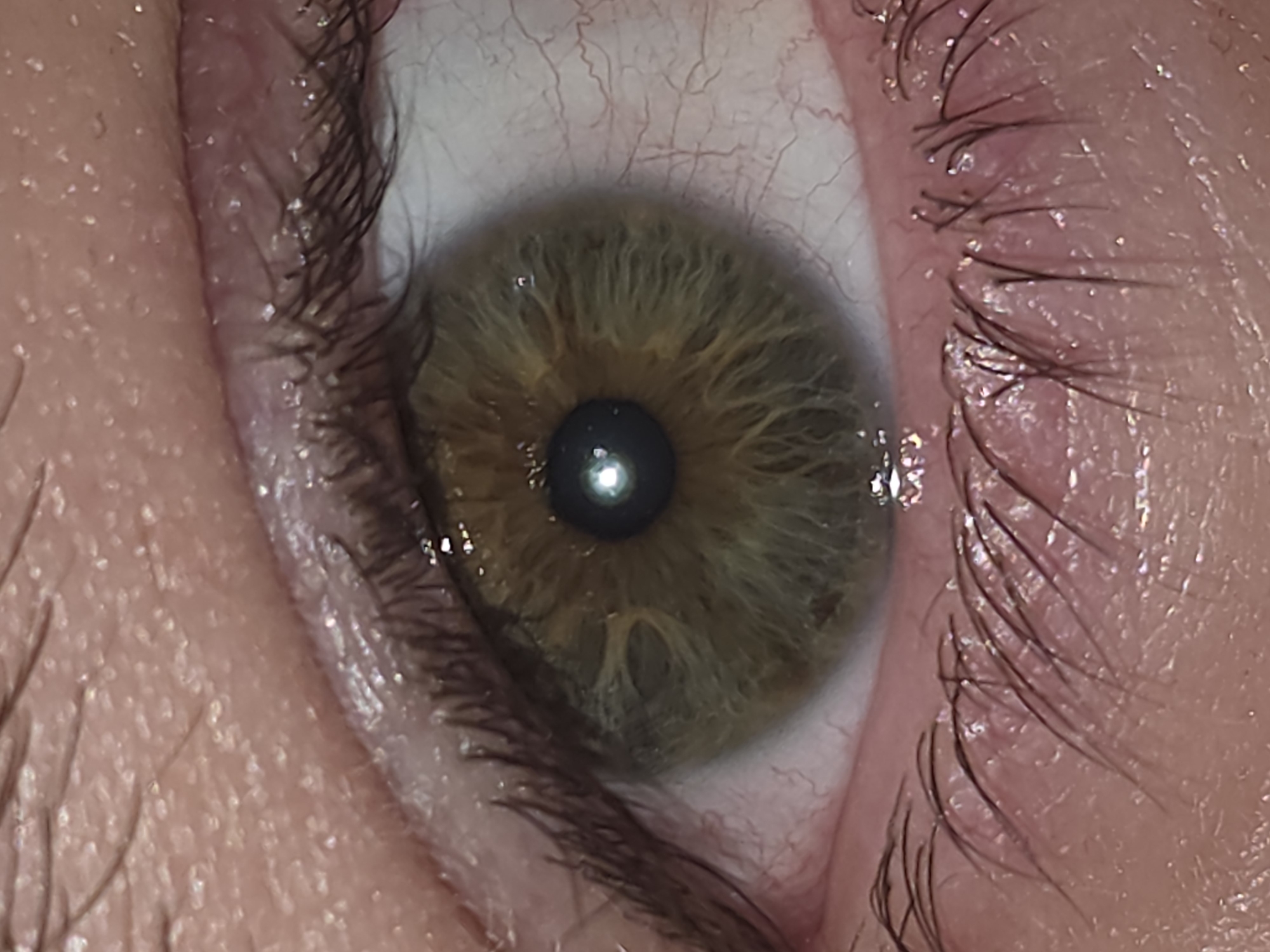 This is a close-up, macro photograph of a human eye, likely taken indoors with artificial lighting. The iris is a heterochromatic hazel, with prominent green and brown tones, and distinct radial striations. The pupil is a dark, circular aperture, reflecting the light source as a bright, starburst-shaped highlight. The sclera, the white part of the eye, is visible and shows a network of fine blood vessels. The eyelids are visible with dark eyelashes. The skin surrounding the eye appears to be light-toned with a textured surface, suggesting pores or fine wrinkles. There is no indication of the eye's location within the city of Plovdiv, Bulgaria, nor are there any people, subjects, objects, or actions beyond the eye itself.