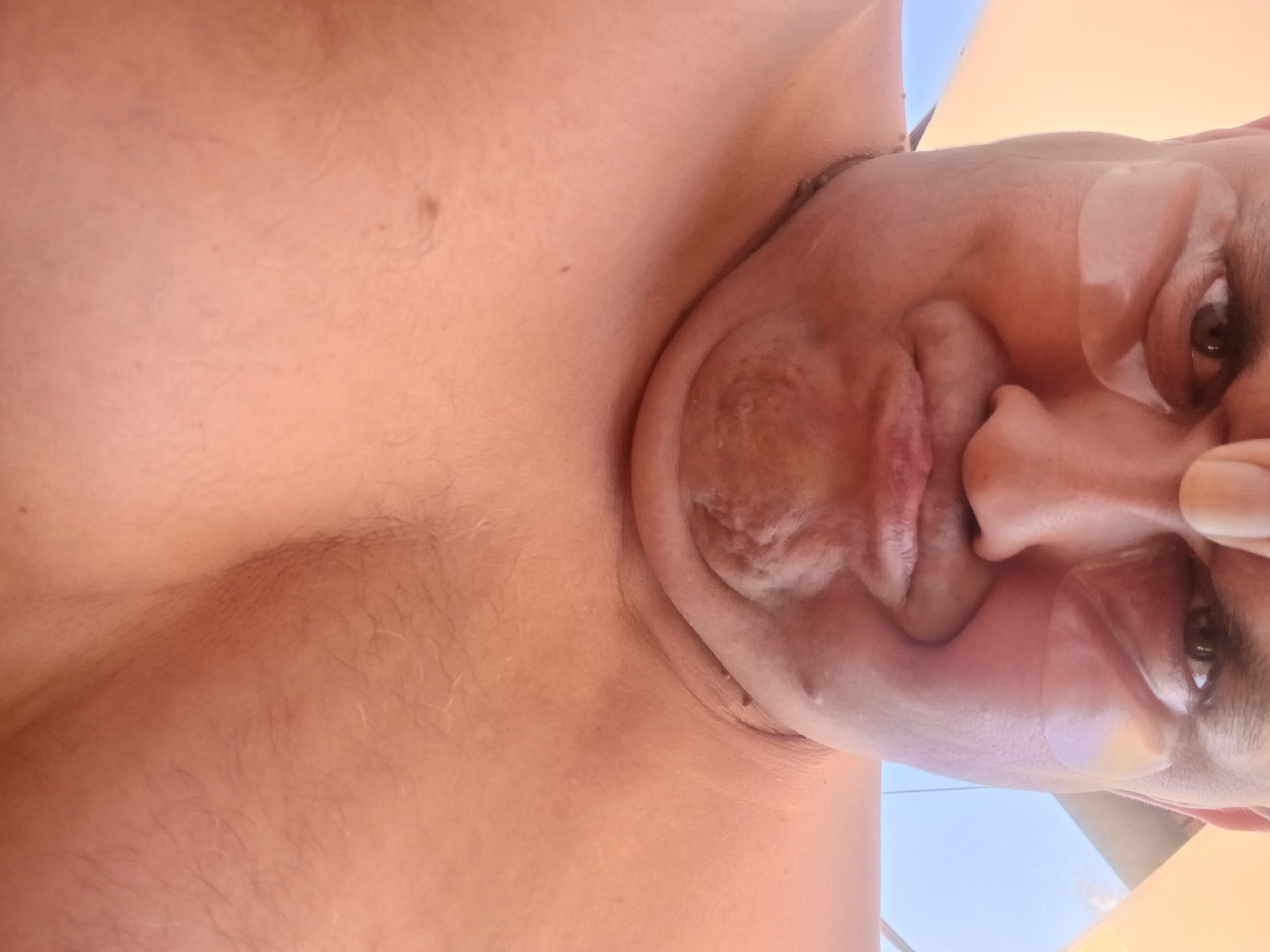 A close-up, low-angle selfie shows a person's face and upper chest. The person has their eyes narrowed and a puckered mouth, with what appear to be under-eye patches applied. The skin is flushed, and there is visible facial hair on the chin and neck. The background is blurred, with a hint of orange and blue, suggesting an outdoor setting, possibly during daylight hours. There are no visible landmarks or context to place this image within Pfarrkirchen, Germany.