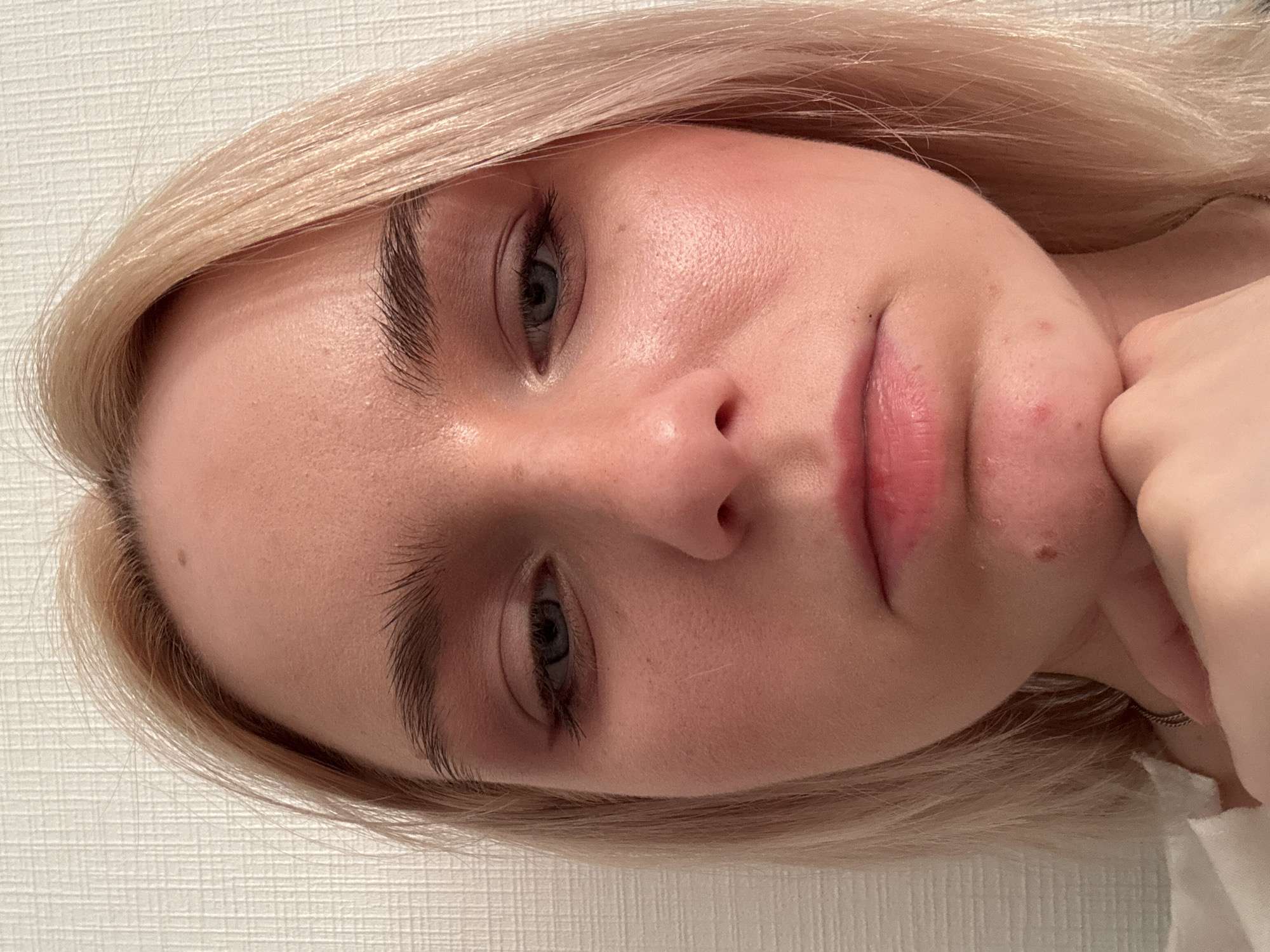 This is a close-up, head-on, front-facing portrait of a young Caucasian woman with blonde hair. She is looking downwards. The woman has fair skin, light eyebrows, and blue eyes. She is wearing light makeup, including eyeshadow and blush. Her lips are pink and slightly parted. There is a small mole on her chin, and a few red blemishes on her chin and jawline. Her hand is resting on her chin. The background is a textured, light-colored wall. The lighting appears to be soft and diffused, suggesting an indoor setting. The image does not contain any elements that would allow for the determination of a specific location in Unknown, Russia, or any other city.