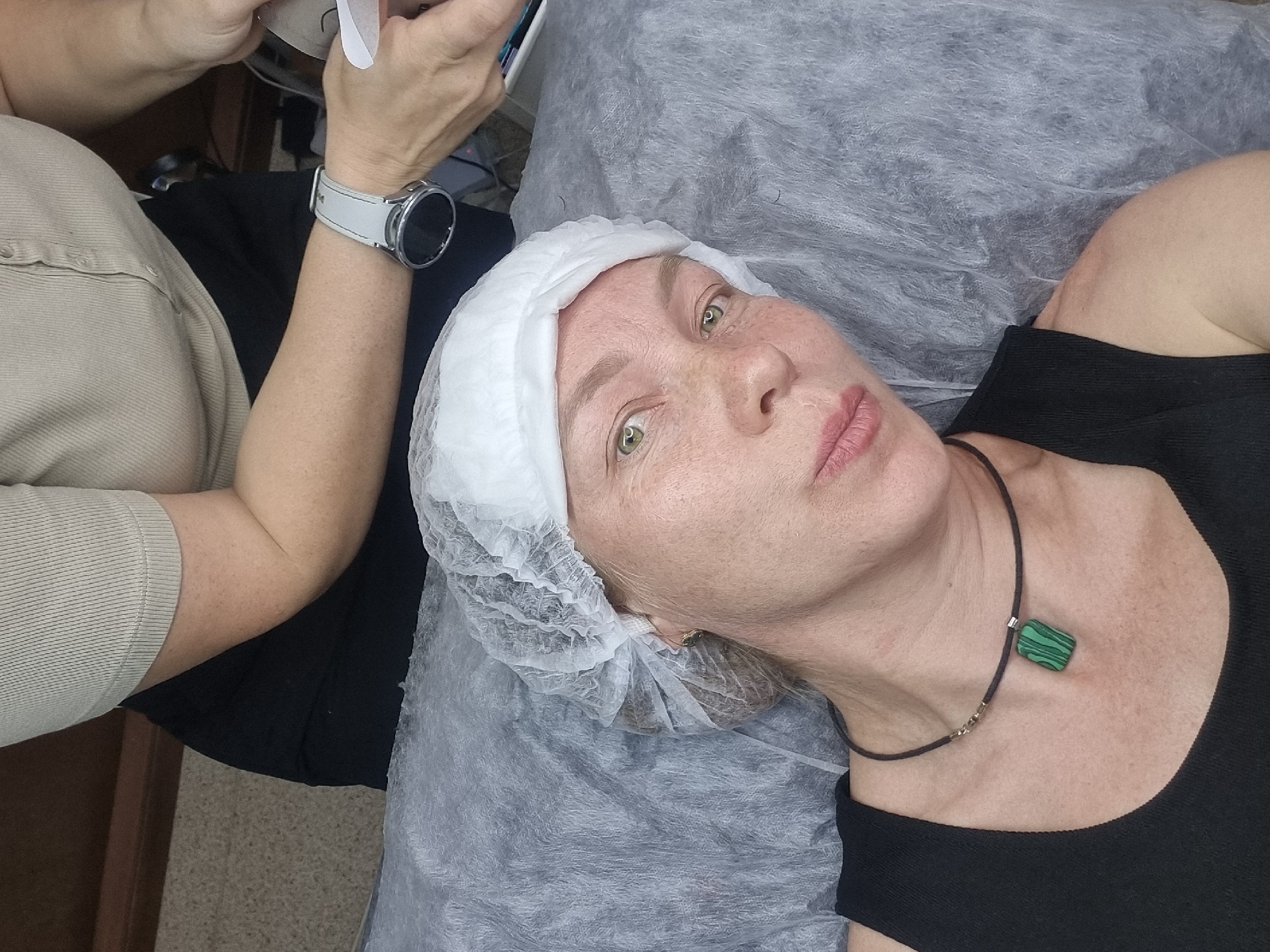 A fair-skinned woman with green eyes lies on a gray crinkled surface, possibly a disposable medical sheet, in a room with beige flooring. She wears a white disposable hair net and a thin black necklace with a rectangular green and black pendant. A person, possibly a medical professional, is positioned to the left and slightly above, wearing a beige short-sleeved shirt and a smartwatch with a white band. The professional holds a device, possibly a scanner or medical instrument, above the woman's face. The scene likely takes place in a medical or beauty treatment facility in Chaikovsky, Russia.