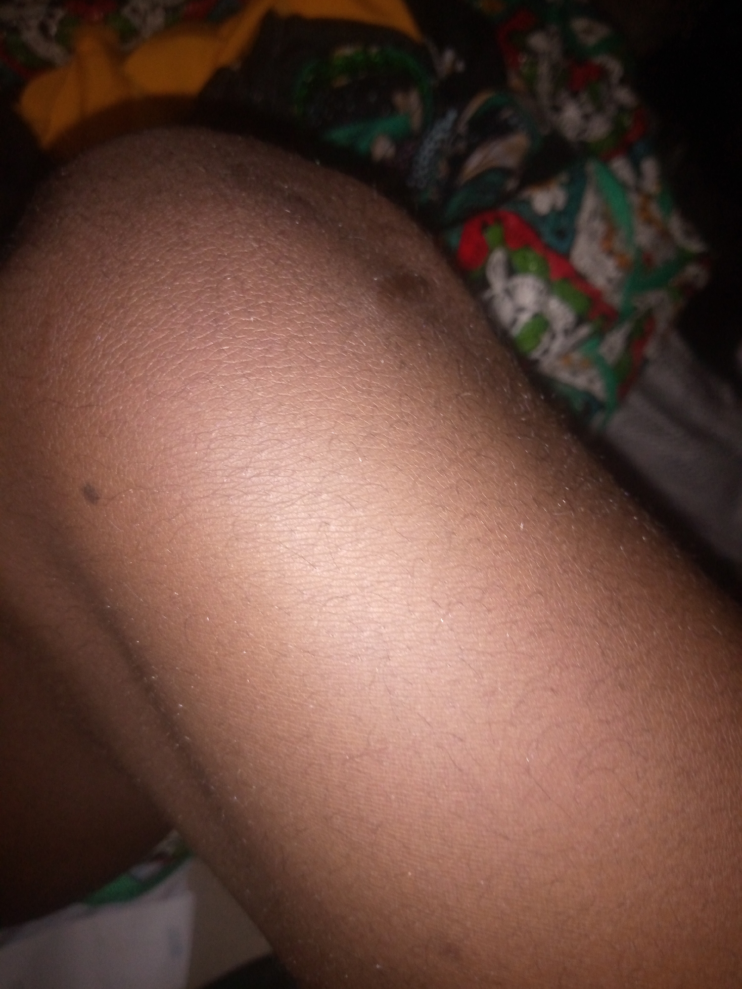 The image is a close-up, unidentifiable view of human skin, likely a leg or arm, with visible pores and fine hairs. The skin tone appears to be a medium brown. In the background, out of focus, are various patterned fabrics, possibly clothing or bedding, in muted colors of yellow, green, red, and white. The lighting is dim, suggesting an indoor setting at night. There is no identifiable location within the city of Jalingo, Nigeria, or any discernible activity or interaction taking place.