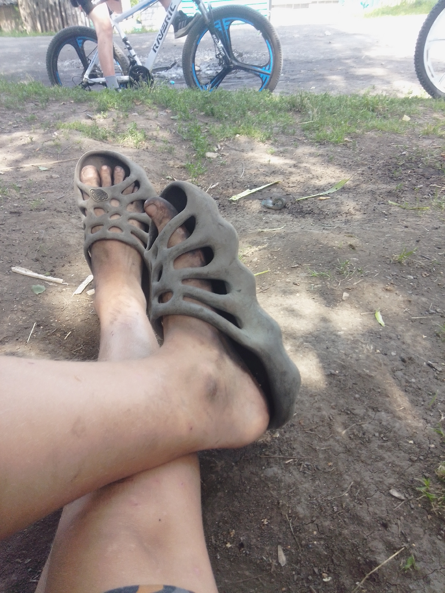 A pair of dirty, grey crocs are worn by a person whose legs are resting on the ground. The person's legs are bare and show some dirt and minor abrasions. In the background, a white bicycle with blue accents is visible, along with a wooden fence and some grass. The scene appears to be outdoors, likely in a yard or park. The location is Guryevsk, Russia.