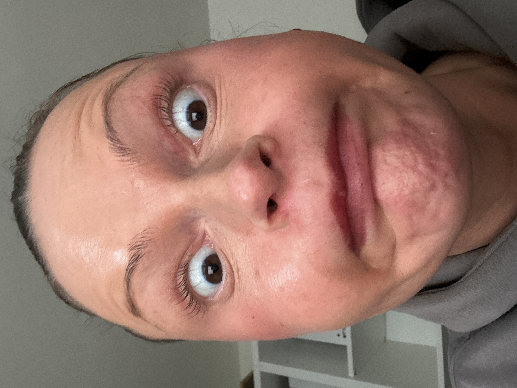 A close-up forensic image depicts the face of an individual, presumed female, making an exaggerated facial expression indoors within a private residence in the city of Wealden, United Kingdom. The subject's face occupies the majority of the frame, characterized by widely opened brown eyes with visible sclera above and below the iris, raised eyebrows, and prominent horizontal wrinkles on the forehead. The mouth is downturned into a distinct pout, with the chin exhibiting minor wrinkles. The skin displays a reddish tone across the cheeks and around the mouth. Dark hair is visible along the hairline. A grey hooded garment is partially visible at the bottom of the frame. The background is out of focus, revealing a portion of a white shelving unit on the left and a plain light grey wall.