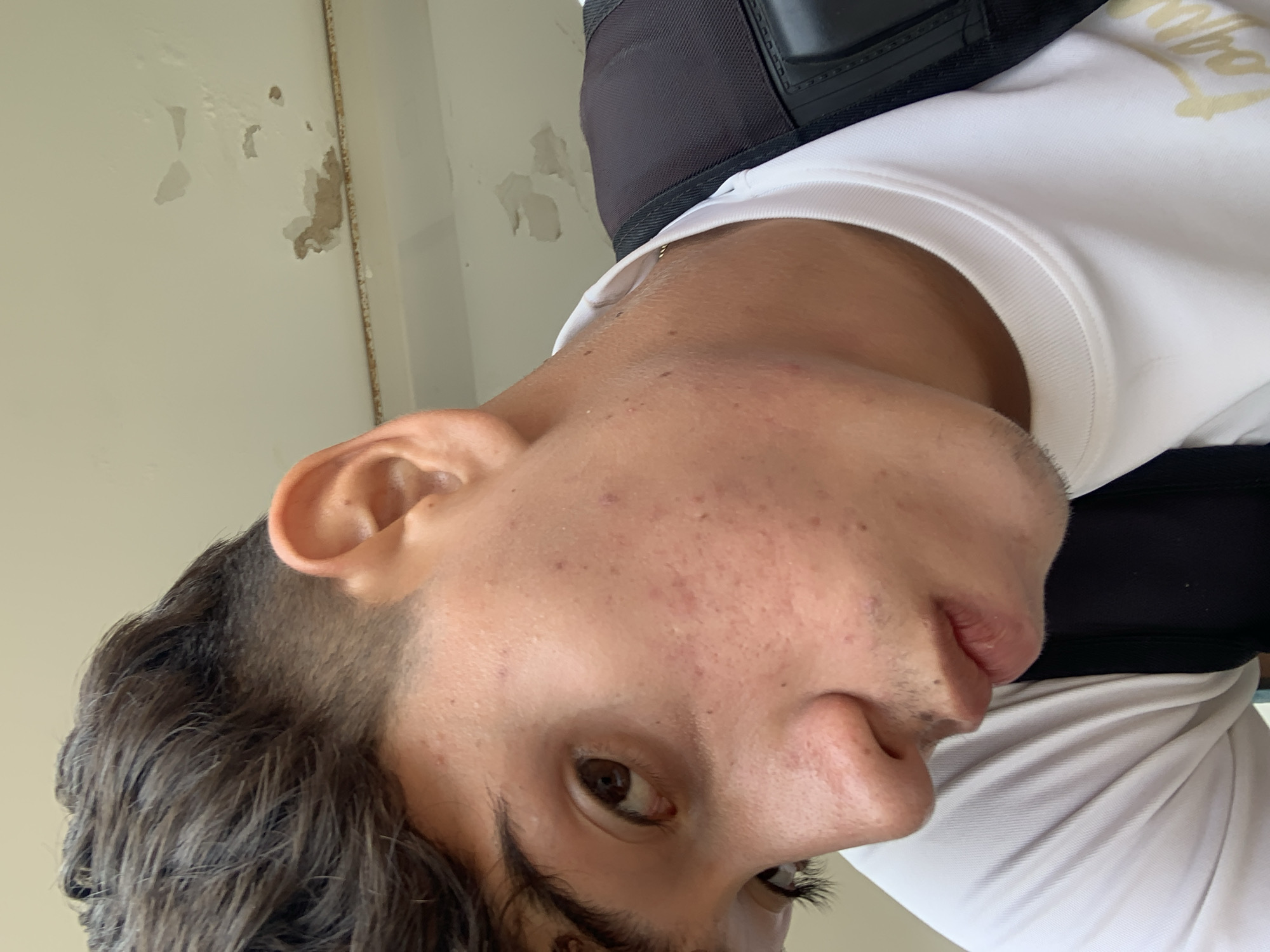 A close-up, low-angle, chest-up, medium shot captures a young man from the chest up. He is facing away from the camera, with his head turned to the left, and his gaze directed towards the left of the frame. The man has dark, short hair with an undercut hairstyle. His skin appears to have some acne blemishes. He is wearing a white t-shirt and a black backpack. The background consists of a pale, possibly stained ceiling with patches of discoloration and peeling paint. The image is taken indoors, suggesting an urban environment in Las Piedras, Venezuela.