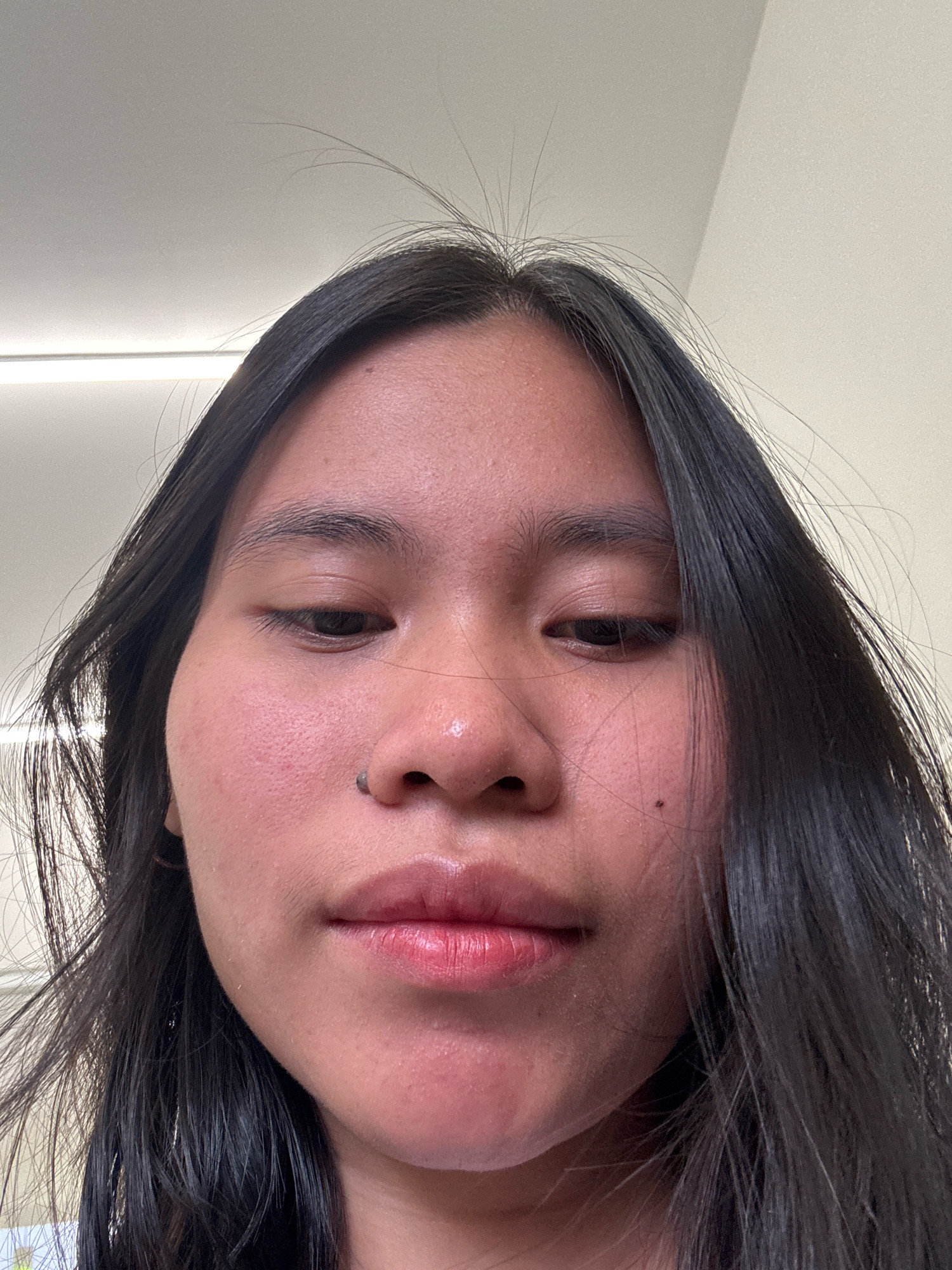 A close-up, low-angle, indoor shot shows the face of a young East Asian female. The female has dark hair, fair skin with some redness on the cheeks and forehead, and dark eyes. A small mole is visible on her nose, and her lips are slightly parted. The background appears to be a wall and a ceiling with fluorescent lighting. The image was taken in East Jakarta, Indonesia.