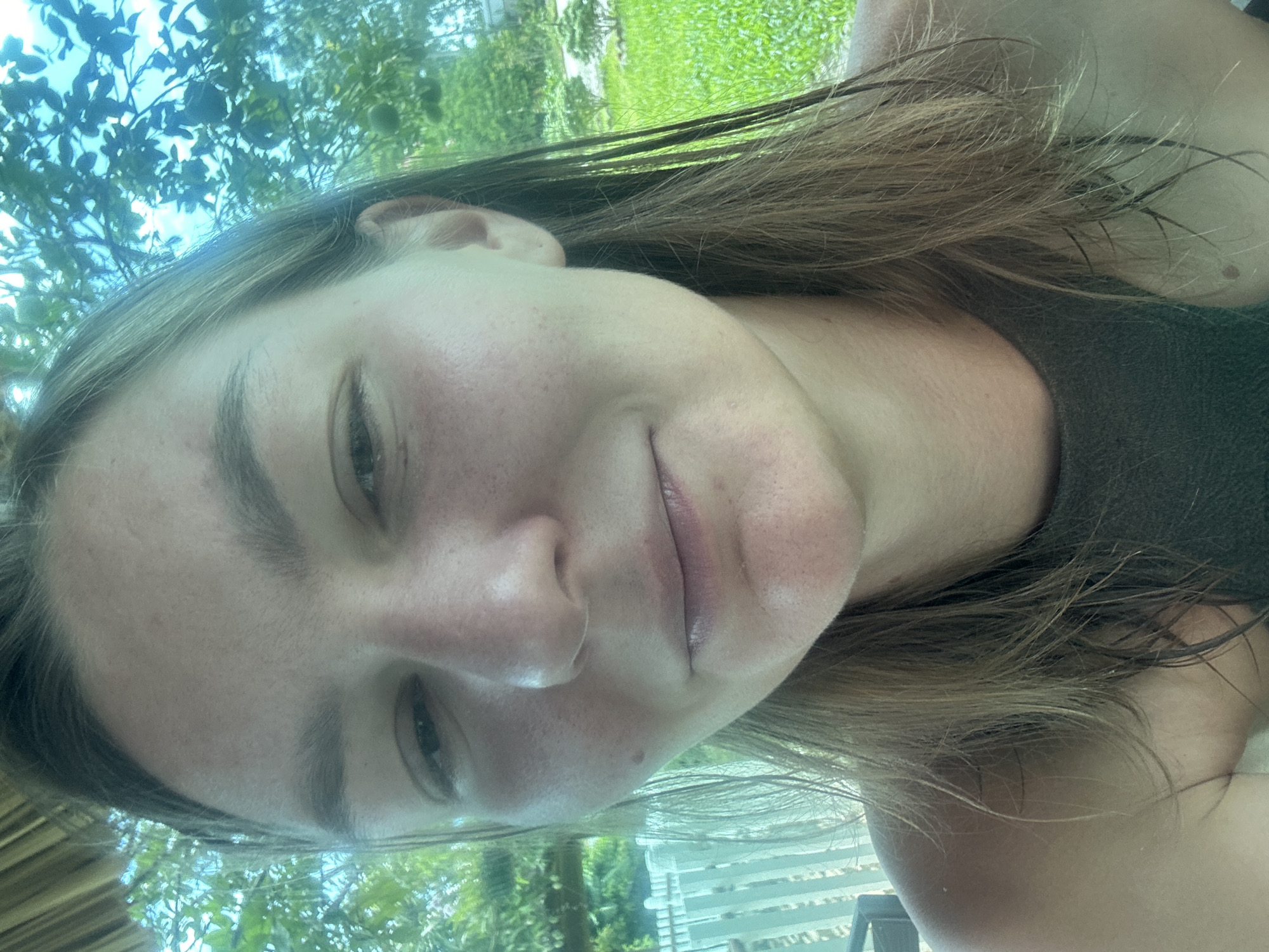 The image displays a close-up portrait of an adult female, facing forward. Her hair is light brown, appears damp, and is styled loosely around her shoulders. Her skin exhibits a natural texture with visible freckles or sunspots across her forehead and cheeks. A small mole is located on her right cheek (viewer's left). Her eyes are partially open, and her lips are slightly parted, revealing a neutral or subtle expression. She is wearing a dark, possibly olive green, sleeveless top.
The background is an outdoor, daytime setting. To the subject's right (viewer's left), a white picket fence is visible, alongside green foliage and a segment of a thatched structure at the upper edge of the frame. To the subject's left (viewer's right), dense green tree foliage and sky are present. Small, round, green objects, consistent with fruit, hang from the branches. A grassy area is discernible in the deeper background. Specific geographic markers or contextual details to confirm the location as Nghia Lo Ward, Vietnam, are not discernible in the image.