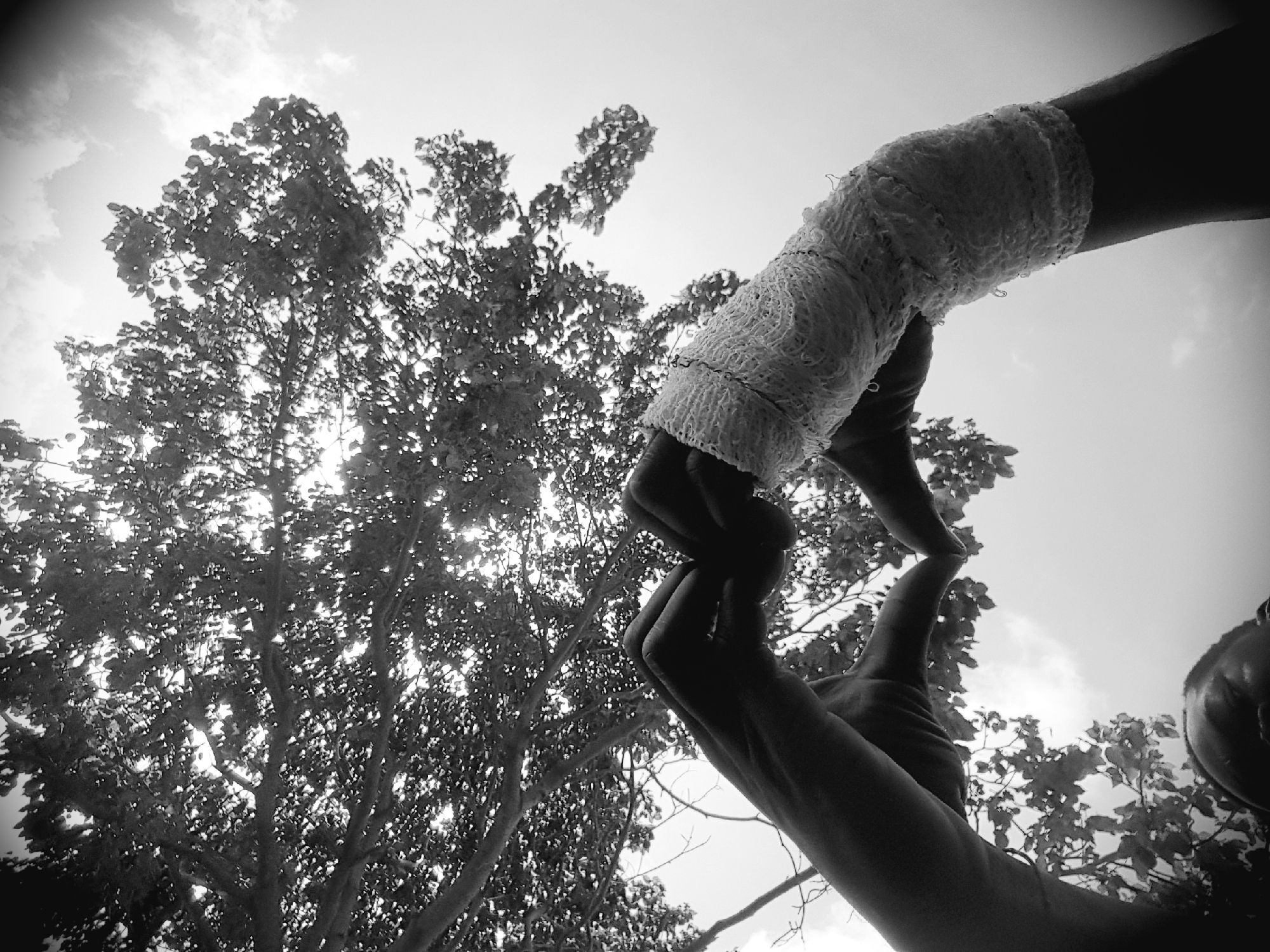 A low-angle, black and white photograph depicts a person's hands forming a heart shape against a dense tree canopy and an overcast sky in Narayi, Nigeria. The person's face is partially visible at the bottom center, gazing upwards. The left arm and hand are bare, while the right forearm and hand are heavily wrapped in a textured, light-colored bandage or cast. The tree's branches and foliage are largely silhouetted against the bright sky, with sunlight piercing through the leaves, creating illuminated gaps. Portions of a cloudy sky are visible in the upper right and through the tree's structure. The scene is characterized by high contrast due to backlighting.