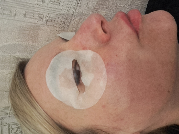 A woman lies on her back, eyes closed, with white patches around each eye, possibly for cosmetic treatment. Her face is pale and freckled. Her lips are pink and slightly parted. Blond hair is visible in the lower left corner. The background appears to be a textured wall. The image is shot from an overhead angle.