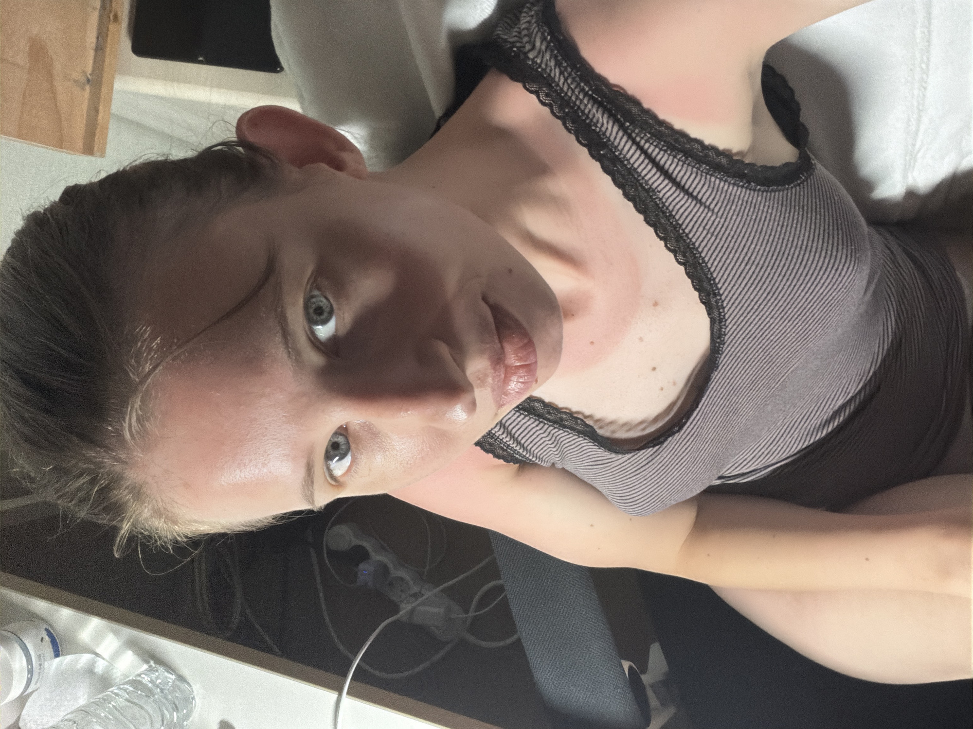A young Caucasian woman is pictured in a close-up, high-angle shot. She has light skin, light blue eyes, and her hair is pulled back. She is wearing a gray and black striped tank top with black lace trim. Her skin appears flushed, particularly on her arms and shoulders, suggesting possible sunburn.
The background is dimly lit and suggests an indoor environment, possibly a bedroom or living space. To the left, a wooden surface with a water bottle and a white jar is visible. Below that, a black object, possibly a speaker or electronic device, and a tangle of cords and power outlets are present. The lighting in the room is artificial, casting shadows and highlighting the woman's facial features and flushed skin. The image does not provide any specific indicators that would allow for its location within Dongducheon-si, South Korea.