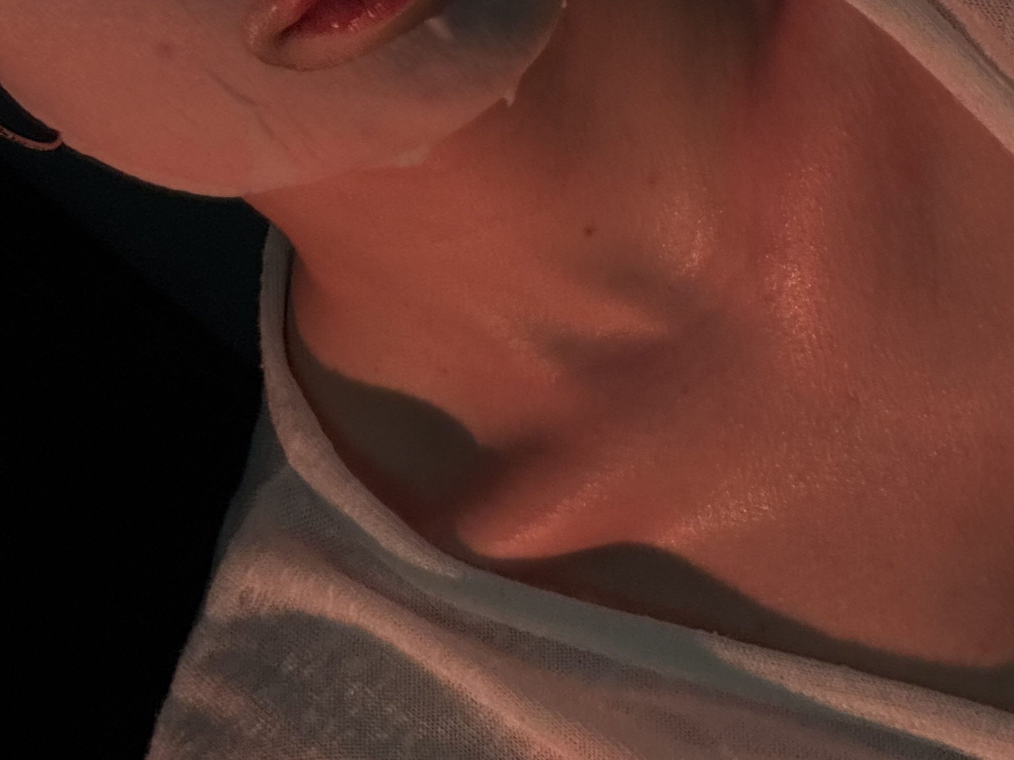 The image shows a close-up view of a person's neck and part of their face, specifically the mouth area. The skin appears reddish due to the lighting. A white substance, likely a skincare product, is visible on the upper lip and cheek area. The neck area shows skin texture and shadowing, with a white fabric, possibly a shirt or towel, draped around the neck. The background is predominantly dark, creating a contrast with the illuminated skin. There is no discernible information in the image to suggest a specific location, such as the city of Chaikovsky, Russia.
