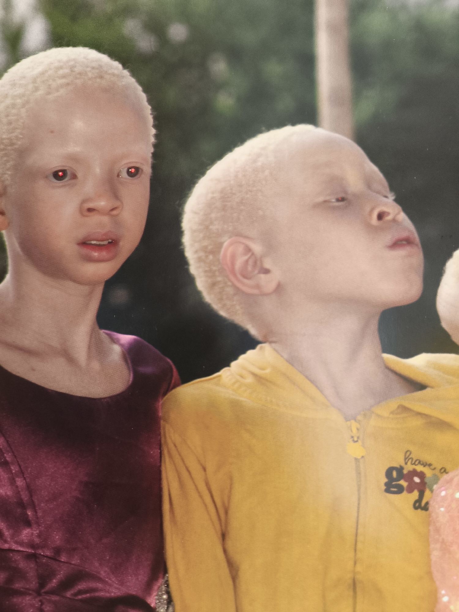 The image is a close-up, waist-up shot of two children with albinism. The child on the left is facing forward, looking slightly to their left, with their mouth open. They are wearing a dark red velvet dress. The child on the right is in profile, facing away from the camera, looking upwards. They are wearing a yellow hooded jacket with a zipper and embroidered decorations that read "have a good day". Both children have pale skin and light-colored hair. The background is out of focus and appears to be an outdoor environment with greenery and a vertical wooden pole. There is no visible indication that this image was taken in Passignano sul Trasimeno, Italy.