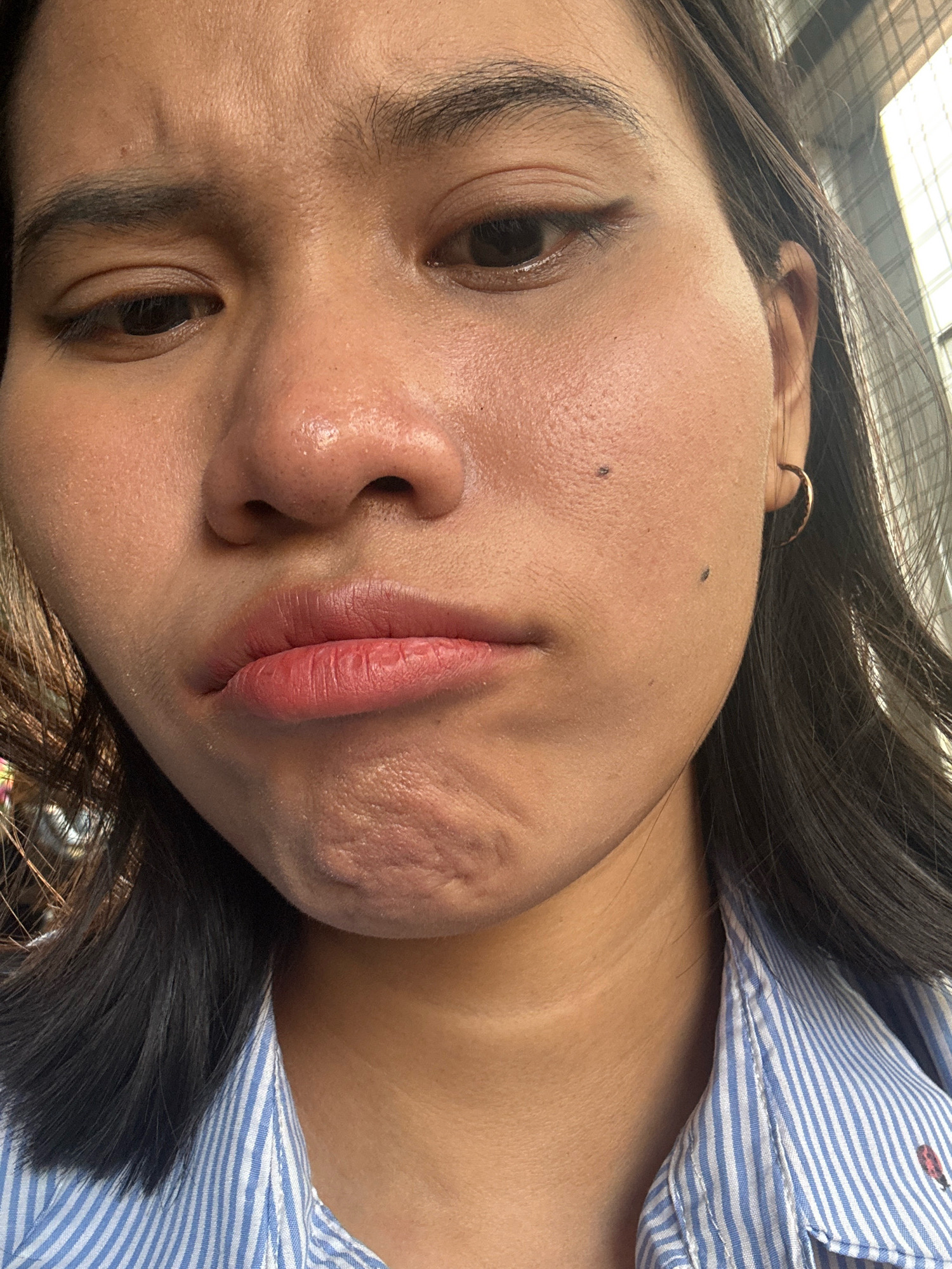 A medium close-up shot shows the face of a young East Asian woman, angled downwards and to the left. She has dark hair, pulled back slightly from her face, and is wearing a blue and white striped collared shirt. Her expression is somber, with her lips pursed and her eyebrows slightly furrowed. Her skin appears slightly oily, with visible pores and a few small moles on her cheek. A small hoop earring is visible in her right ear. The background is out of focus, but appears to be an urban environment with some structural elements, possibly a building or a fence, suggesting she might be outdoors in East Jakarta, Indonesia.