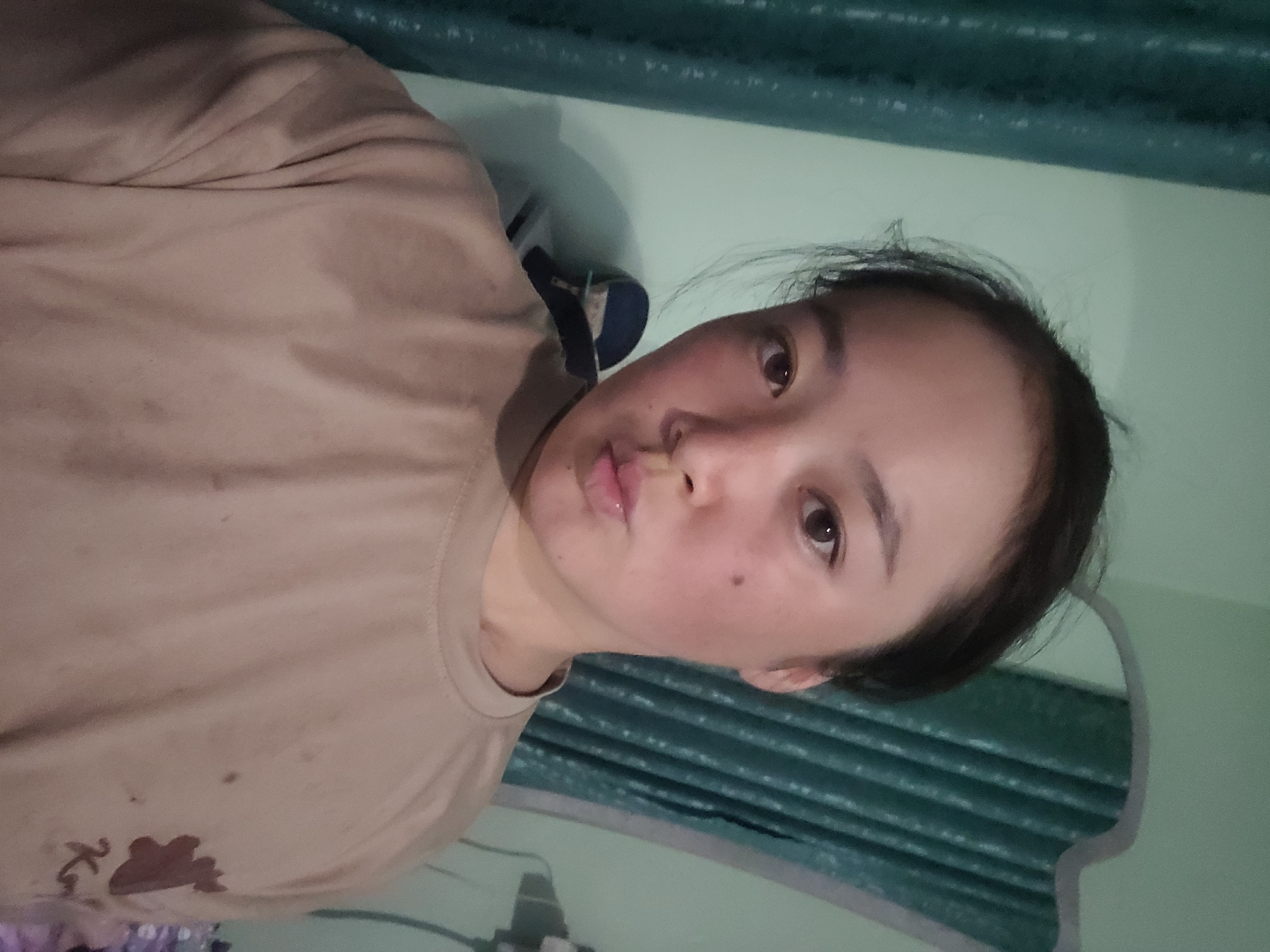 A young Asian woman with dark hair pulled back is looking at the camera, making a kissy face. She is wearing a tan t-shirt with some dark smudges and a brown graphic on the left side of her chest. Her skin is flushed red, and she has some darker spots on her cheeks. In the background, there are teal curtains and a pale green wall, possibly indicating an indoor setting in a residential area of Кыз-Булак, Kyrgyzstan. A dark object, possibly a bag, is visible on a surface behind her.