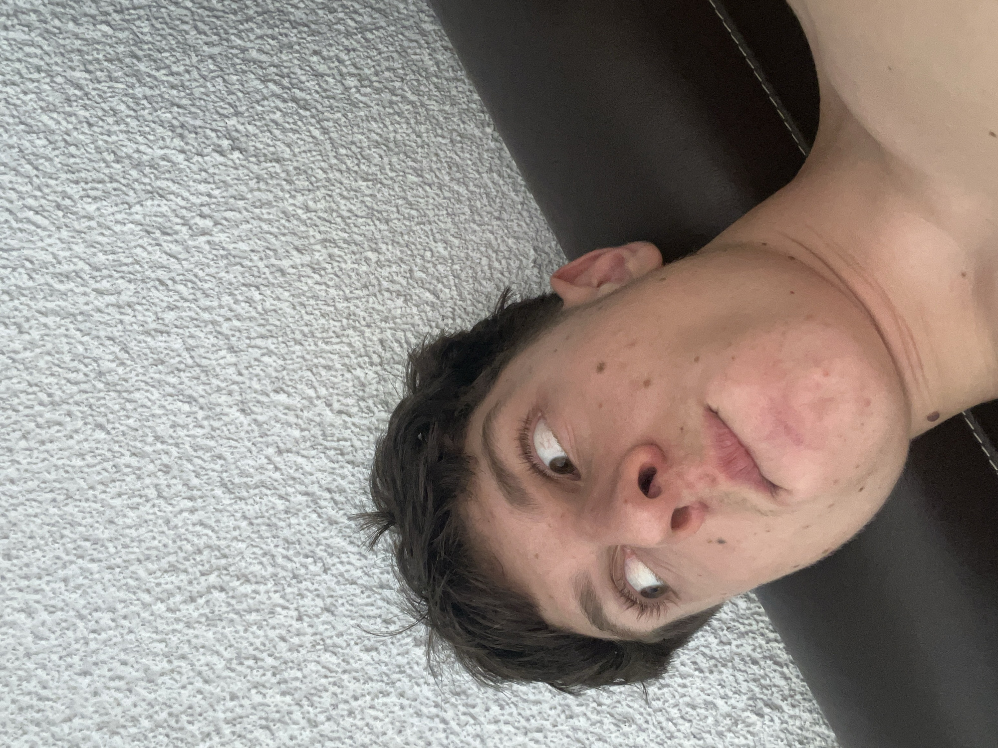 The image is a close-up, low-angle, and tilted portrait of a young, light-skinned male individual, situated in the city of Zlatograd, Bulgaria. The subject has short, dark, tousled hair and is looking upwards and to the viewer's right, with his eyes wide and his lips slightly pursed. Numerous small moles and freckles are visible across his face, neck, and upper chest/shoulder. He appears shirtless, exposing his bare neck, collarbone, and the upper part of his right shoulder. The upper background features a uniformly textured white wall, consistent with a stucco or popcorn finish. The lower background shows a dark, smooth surface, likely a headboard or furniture piece, characterized by a light-colored stitched seam running diagonally across it. The subject's gaze and facial expression suggest an action of observing or contemplating something positioned out of frame above and to his right.