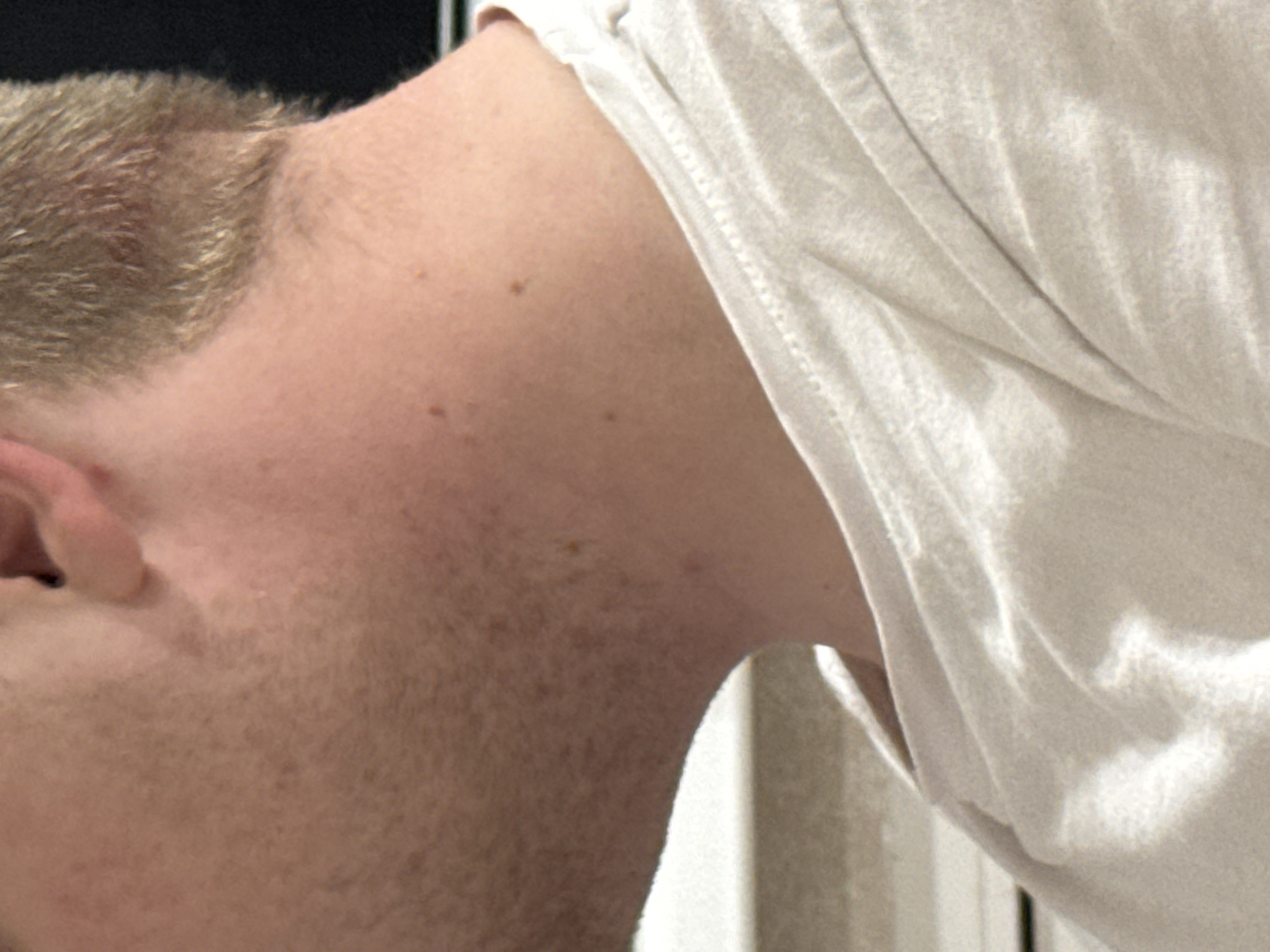 The image shows a close-up profile view of a person's neck and shoulder area, focusing on the skin and part of their hair and clothing. The skin appears fair and has several small, dark moles visible. The hair is short and light brown. The person is wearing a light-colored t-shirt, with the neckline and a portion of the shoulder visible. The background is out of focus, but suggests an indoor setting with some horizontal lines that could be furniture or a wall. There is no visible indication of the city of Saratov, Russia, or any specific location within it. The image is purely a close-up portrait of a person's upper body.