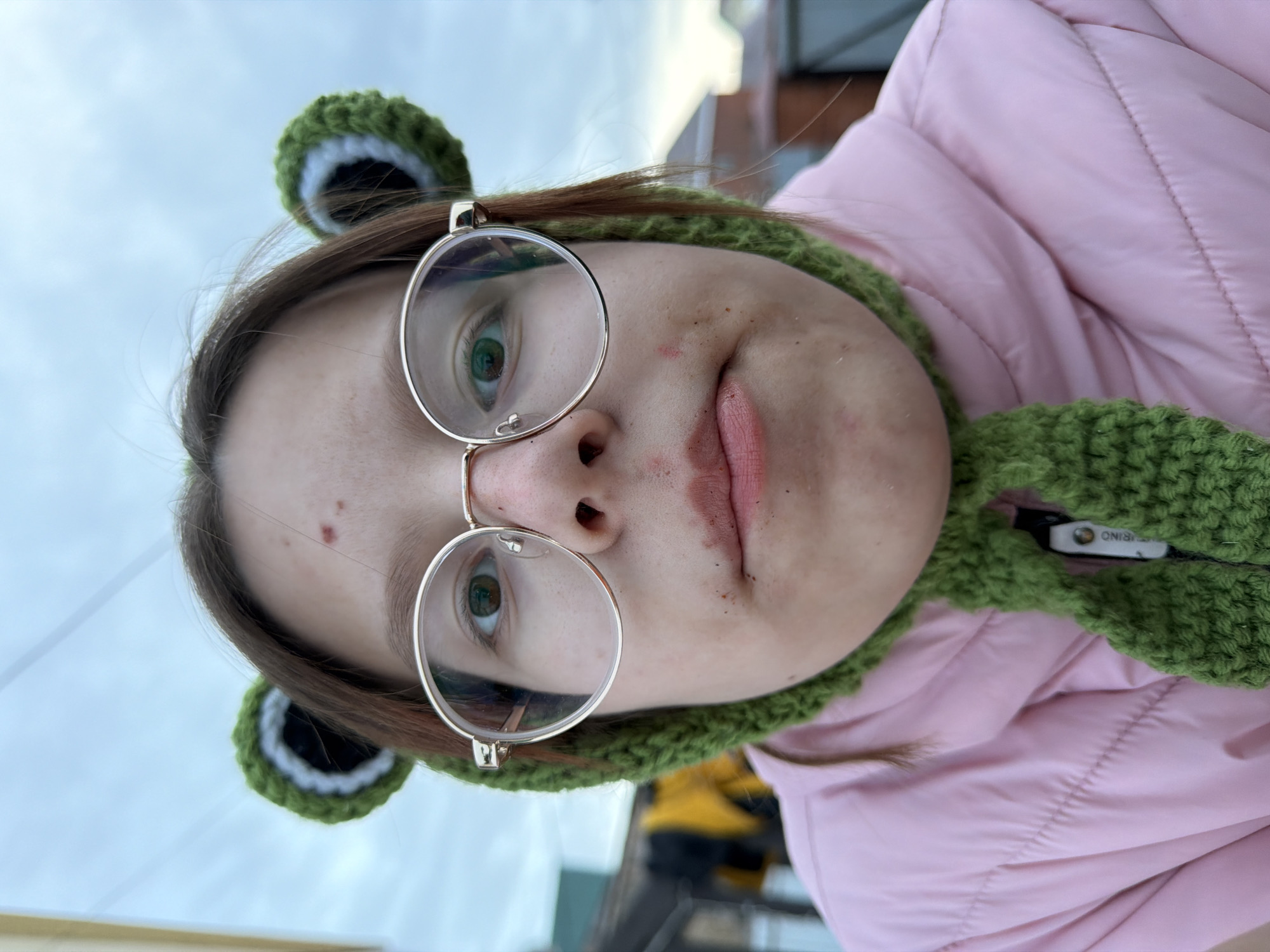 The scene depicts a close-up, low-angle portrait of a young individual outdoors in Chaikovsky, Russia. The subject, centrally framed, has light skin, brown hair, and wears circular eyeglasses with gold-toned frames. Observable skin imperfections include multiple erythematous papules and macules on the forehead, nasal bridge, and cheeks. The individual is wearing a green crocheted balaclava-style hat featuring two prominent ears with concentric black and white rings. A pink puffer jacket is worn, with a white fabric tag bearing the word "MURINO" visible on the zipper pull. The subject's left eye displays a brown iris, while the right eye shows a green/hazel iris, both looking directly at the camera. The mouth is closed with the lips slightly pursed. The background is blurred, revealing an overcast, light-colored sky above indistinct architectural elements, including dark and light building structures and a reddish-brown roofline, suggesting an outdoor, possibly residential, setting.
