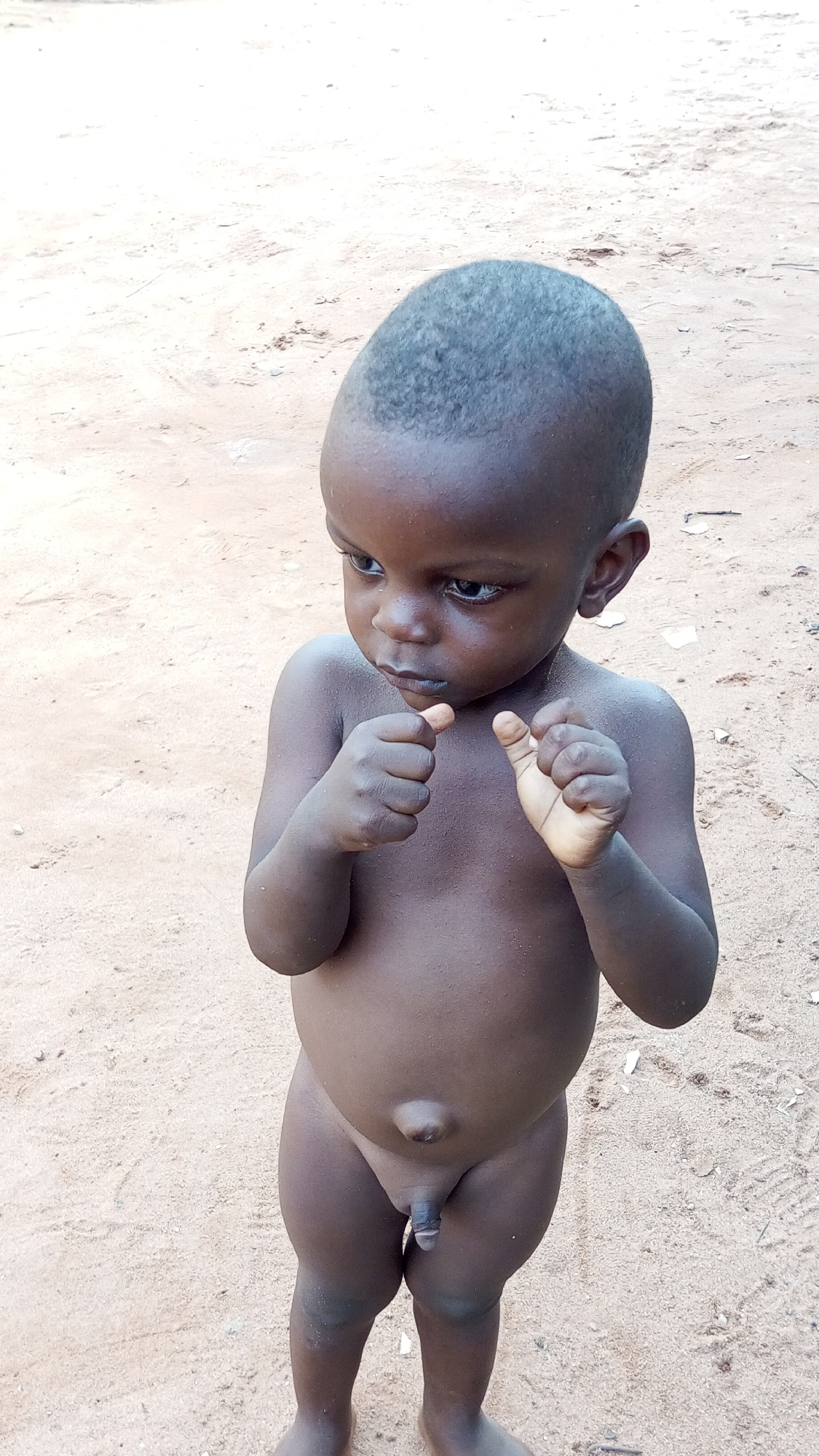 A nude, dark-skinned toddler stands on a sandy surface. The child has short, close-cropped hair and is looking towards the left. The child's hands are held up near the chest with fingers curled inward. The background consists of a light-colored, sandy ground. The location is likely Nkpor, Nigeria.