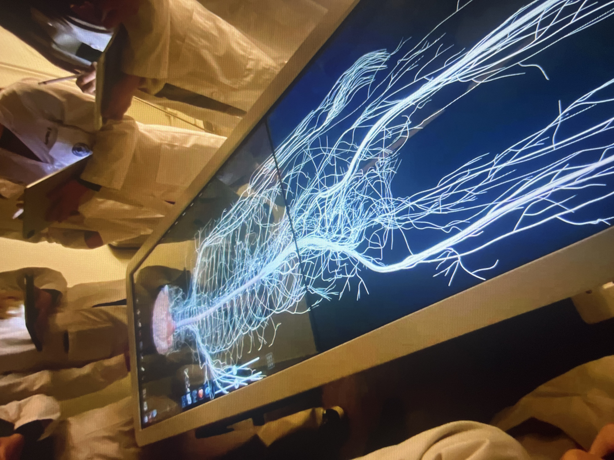 The image shows a computer monitor displaying a 3D model of the human nervous system. The model is shown against a dark blue background with a red anatomical model. Multiple people, possibly medical professionals, are gathered around the monitor. The people are wearing white coats. One is holding a tablet. The location and city are unknown.