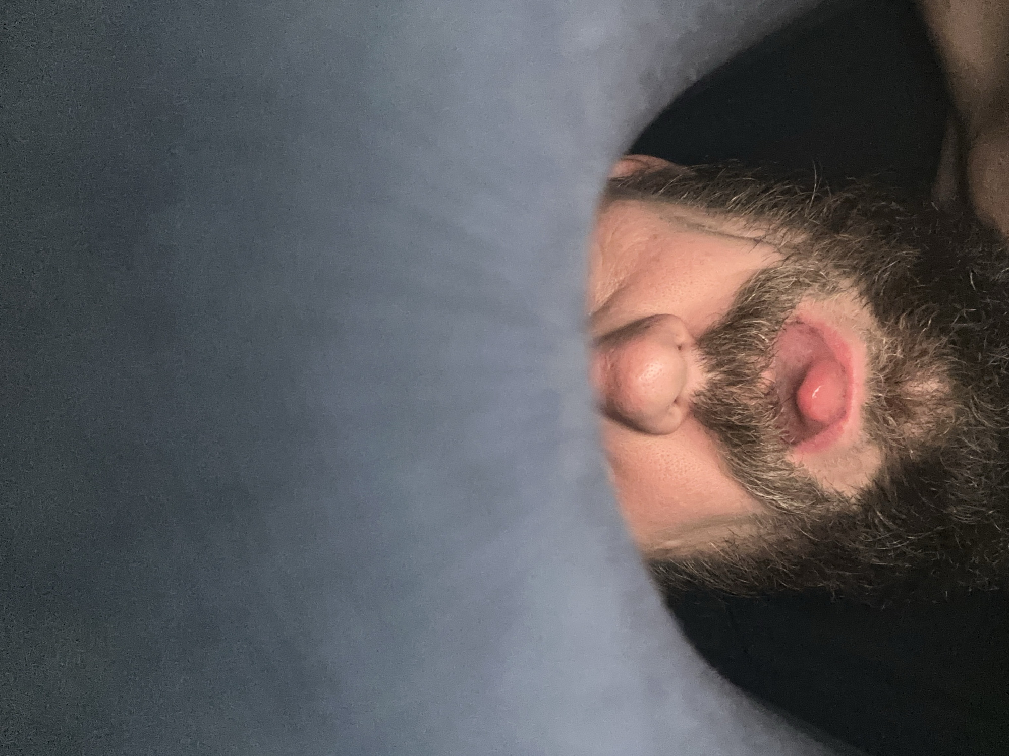 A close-up, angled view shows a person's face, including their nose, ear, and beard. The ear appears to have a protruding lesion or growth. The person is partially obscured by a blue fabric or surface on the left side of the frame. The right side of the image fades into darkness. The location in the city of Fethiye, Turkey is not discernible from the image.