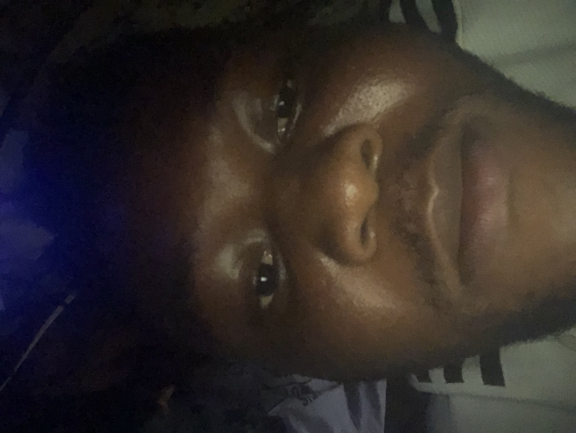 Here is a forensic description of the image:
The image shows a close-up of a person's face, likely taken with a camera phone. The person has dark skin, a prominent nose, and dark eyes. The lighting is poor, with the left side of the image appearing dark. A white and black striped pattern is visible on what appears to be the person's clothing. The background is obscured. No location information is discernible from the image.