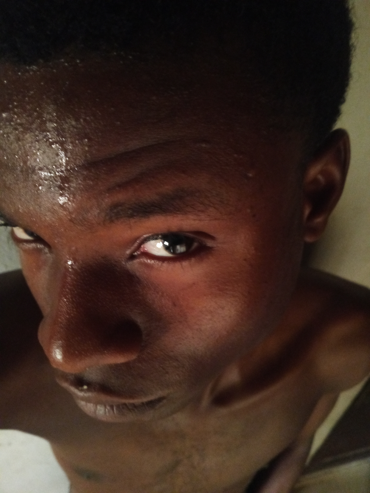 A close-up, angled shot of a dark-skinned person, seemingly male, likely in their late teens or early twenties. The forehead and face appear to be sweating. The person has short, dark hair and dark eyes. The background is indistinct, but appears to be a light-colored wall. The person is located in Narayi, Nigeria.