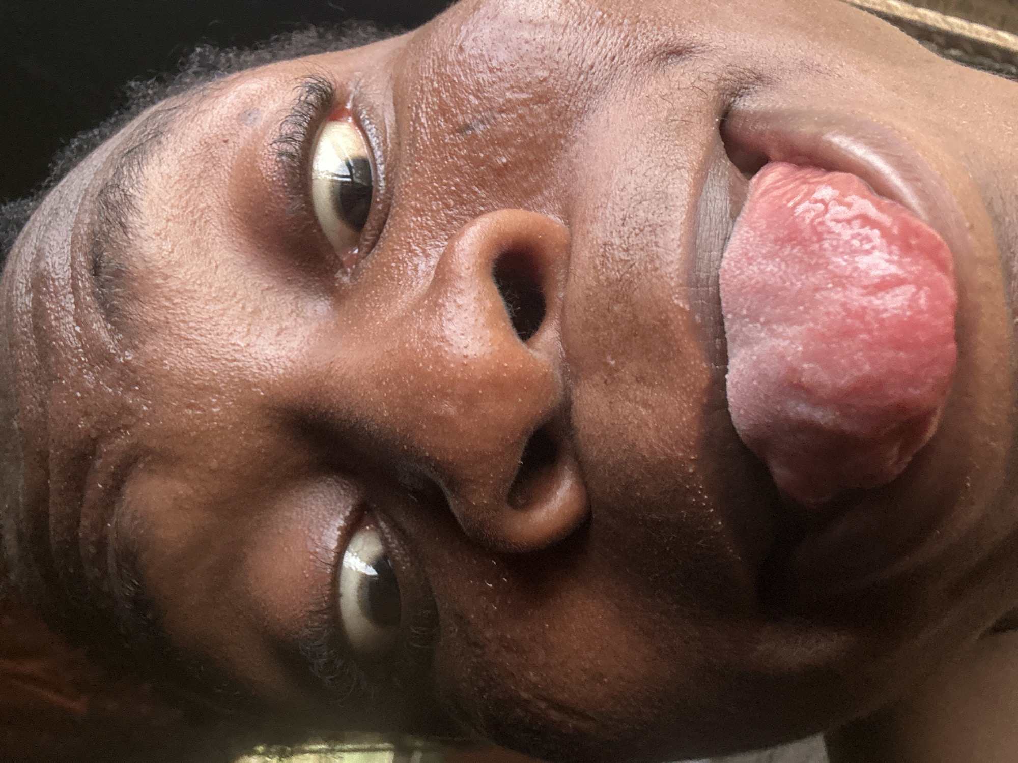 The image shows a close-up of a person's face, tilted and positioned with the head towards the top and the chin towards the bottom. The person has dark skin and their face appears to be slightly oily or sweaty. Their tongue is extended outward, appearing pink and textured. The eyes are visible, showing the irises and reflections. The setting is unclear, providing no location information.
