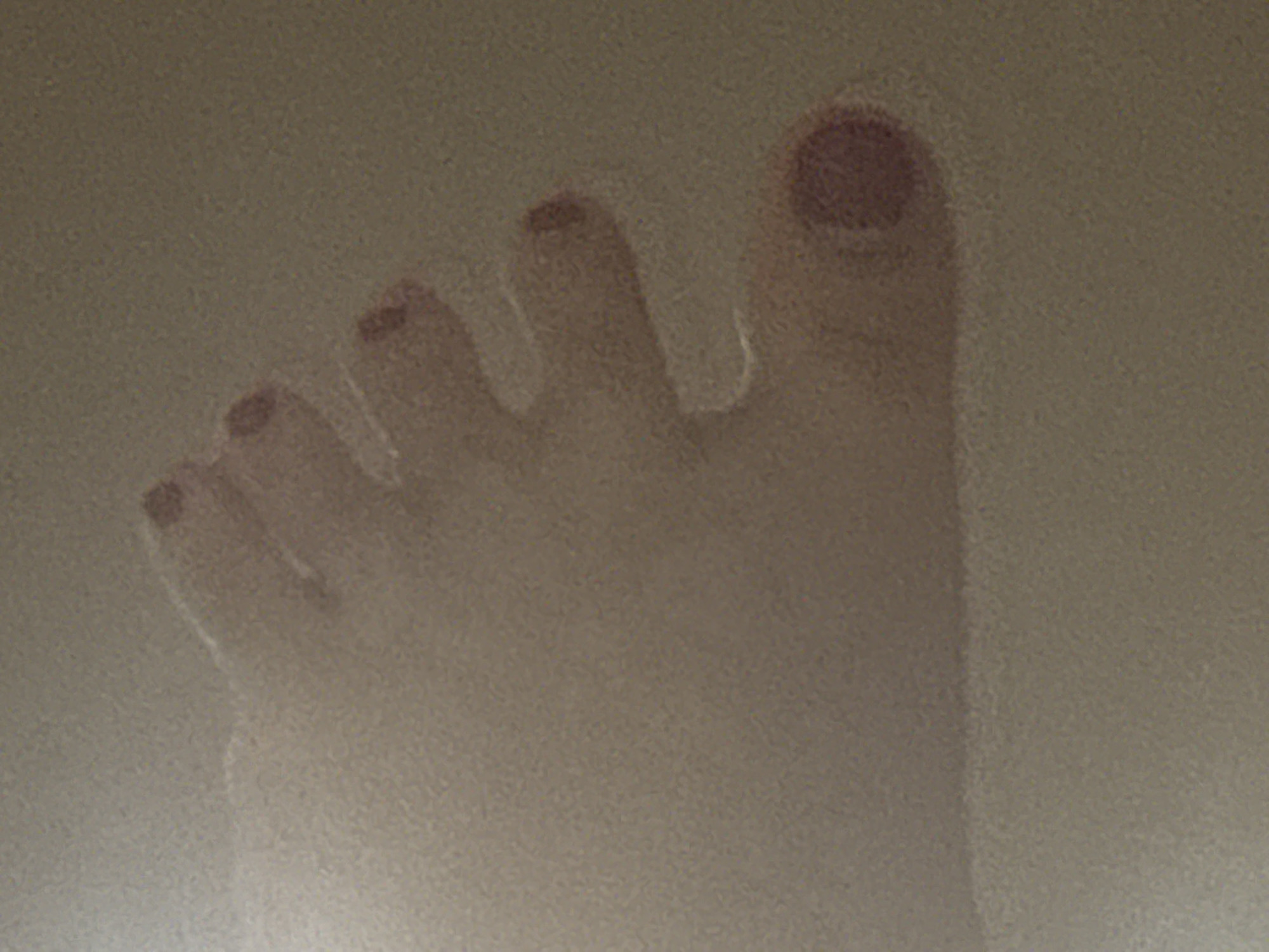 The image is a close-up, low-resolution, grainy photograph of a person's foot with painted toenails. The foot is positioned at an angle, with the toes extending from the left side of the frame towards the right. The toenails appear to be painted a dark color, possibly red or burgundy. The skin tone of the foot is light. The background is a uniform, neutral color, possibly a wall or floor, with a textured appearance. There are no discernible elements in the image that would allow for the identification of a specific location in Saratov, Russia. The image focuses solely on the details of the foot.