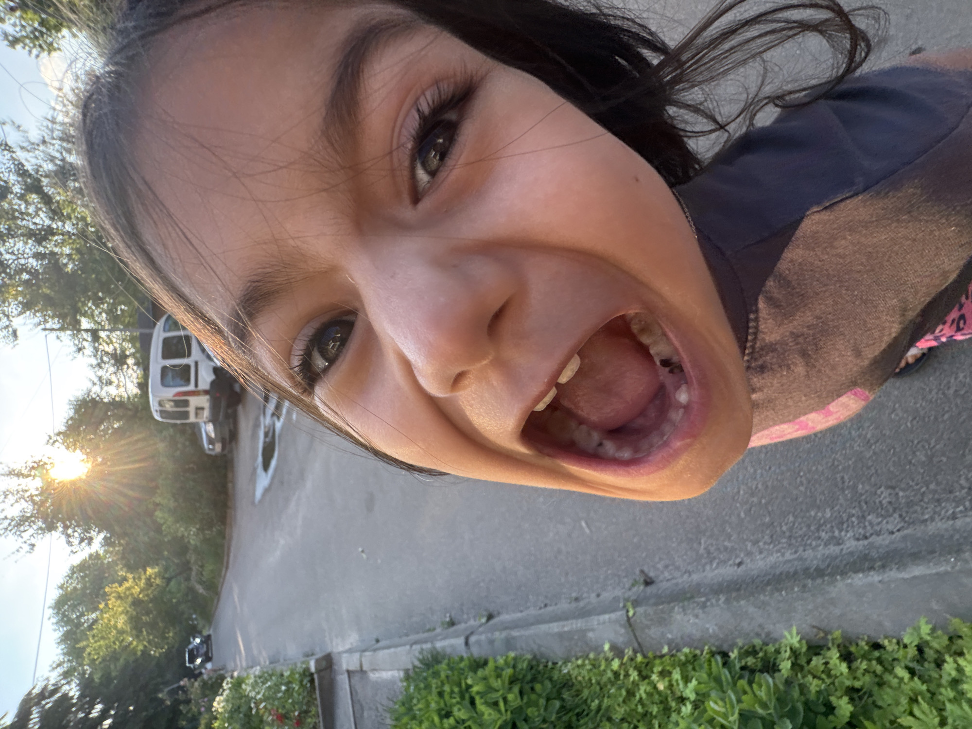 The image shows a close-up, wide-angle shot of a young girl's face with her mouth open wide, revealing her teeth and tongue. The girl has dark hair and is wearing a dark t-shirt with pink accents on her lower garment. She appears to be outdoors, with a paved road and a grassy area visible to her left. In the background, there are trees, a white van, and a car. The sun is shining brightly, creating a lens flare effect in the upper left quadrant of the image. The scene is set in the city of Unknown, Unknown.