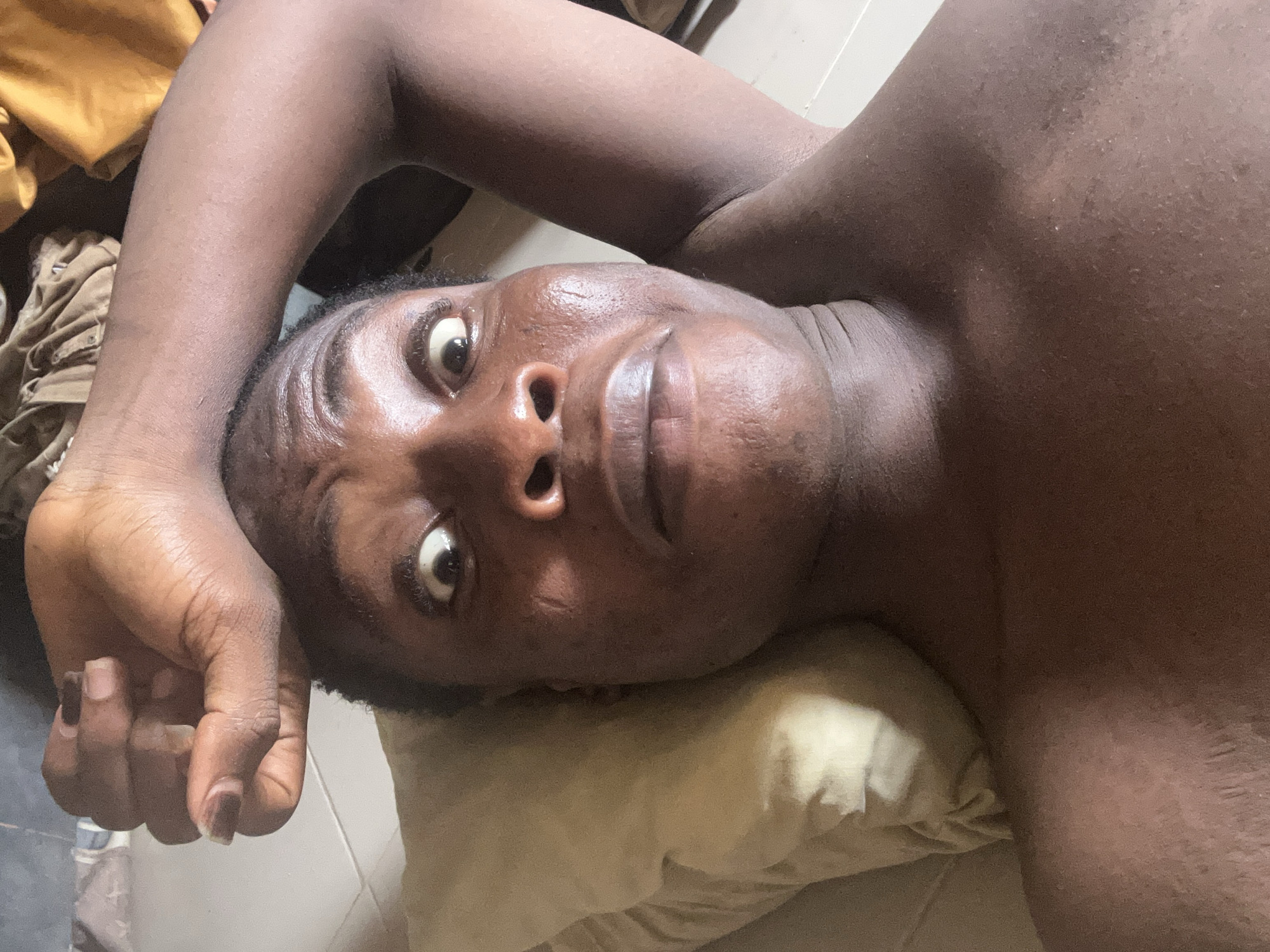 A close-up, tilted shot shows a person with dark skin lying on a light-colored pillow. The person's head rests on the pillow, and their left arm is bent with their hand near their head. The person's eyes are wide open, and they are looking towards the camera. The background is blurry, but it appears to be a room with some clothes or other items in the upper left corner. The location is specified as Unknown, Unknown.