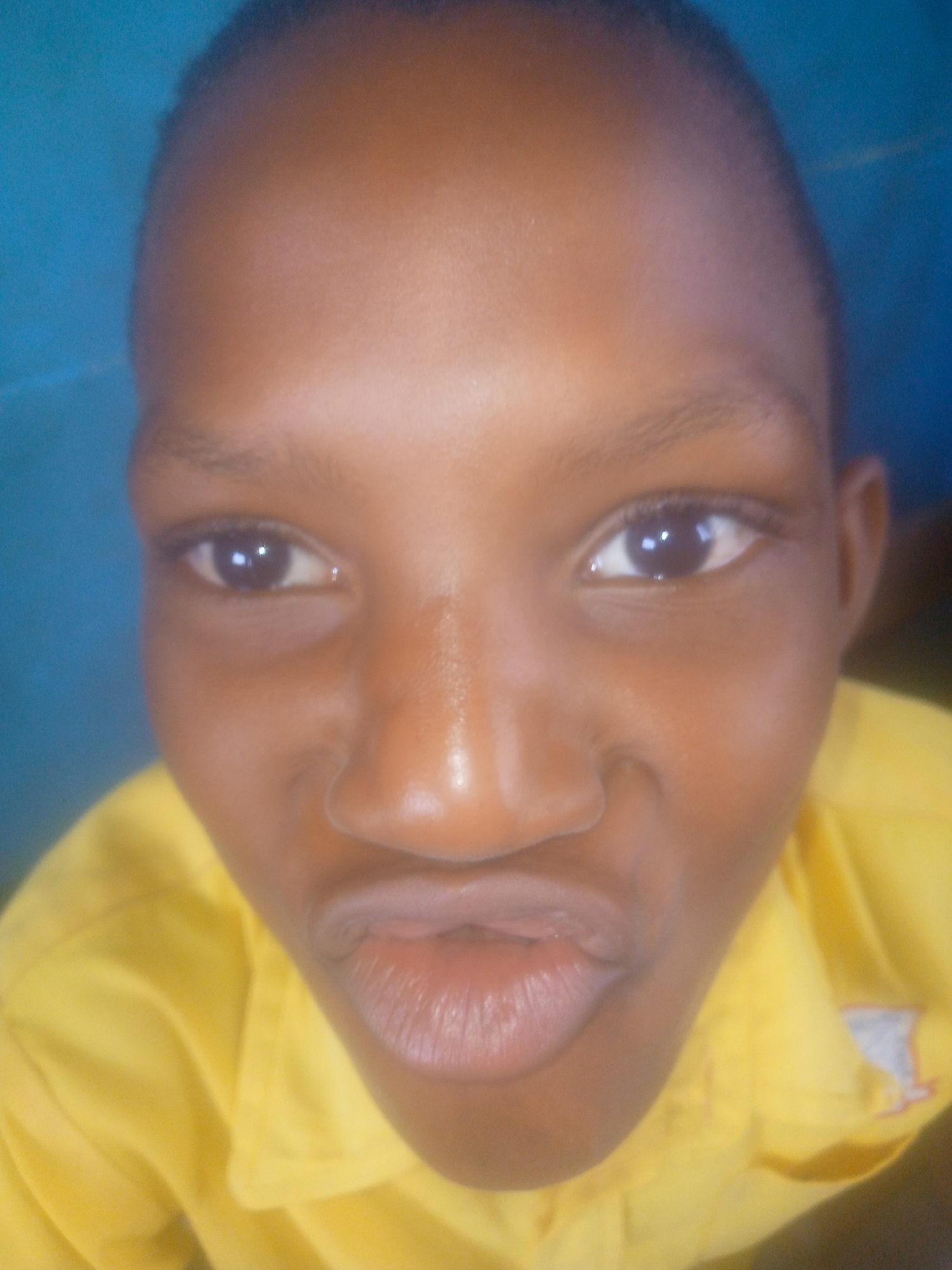 A close-up, slightly distorted, headshot shows a dark-skinned person with short hair, prominent facial features, and pursed lips. The person is wearing a yellow collared shirt. The background is a blurry blue. There is no information to indicate this image was taken in Ikorodu, Nigeria.