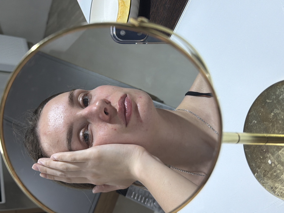 This image depicts a female individual's reflection captured in a round, gold-framed tabletop mirror within an indoor setting in Chaikovsky, Russia. The subject, a fair-skinned female, is shown from the chest up, directly facing the camera's perspective through the mirror. She has visible blemishes and redness on her forehead, cheeks, and chin. Her eyes are light-colored, and her lips appear full, with a light lip color. Her left hand is raised and placed against the left side of her face, covering her ear and part of her cheek, with fingers slightly splayed. She wears a thin, silver-colored chain necklace and a dark strap garment is visible on her right shoulder.
In the reflected background to the right of the subject, a smartphone with a dark case and a multi-lens camera module is visible, positioned as if capturing the mirror's reflection. Further to the right, a white ceramic bowl containing a yellow substance is partially visible. The immediate surface supporting these items appears to be a clean, white tabletop or countertop. Behind this, a darker, possibly wooden, surface extends horizontally, backed by a light-colored wall or cabinet structure. The lighting is even, suggesting an interior light source.
