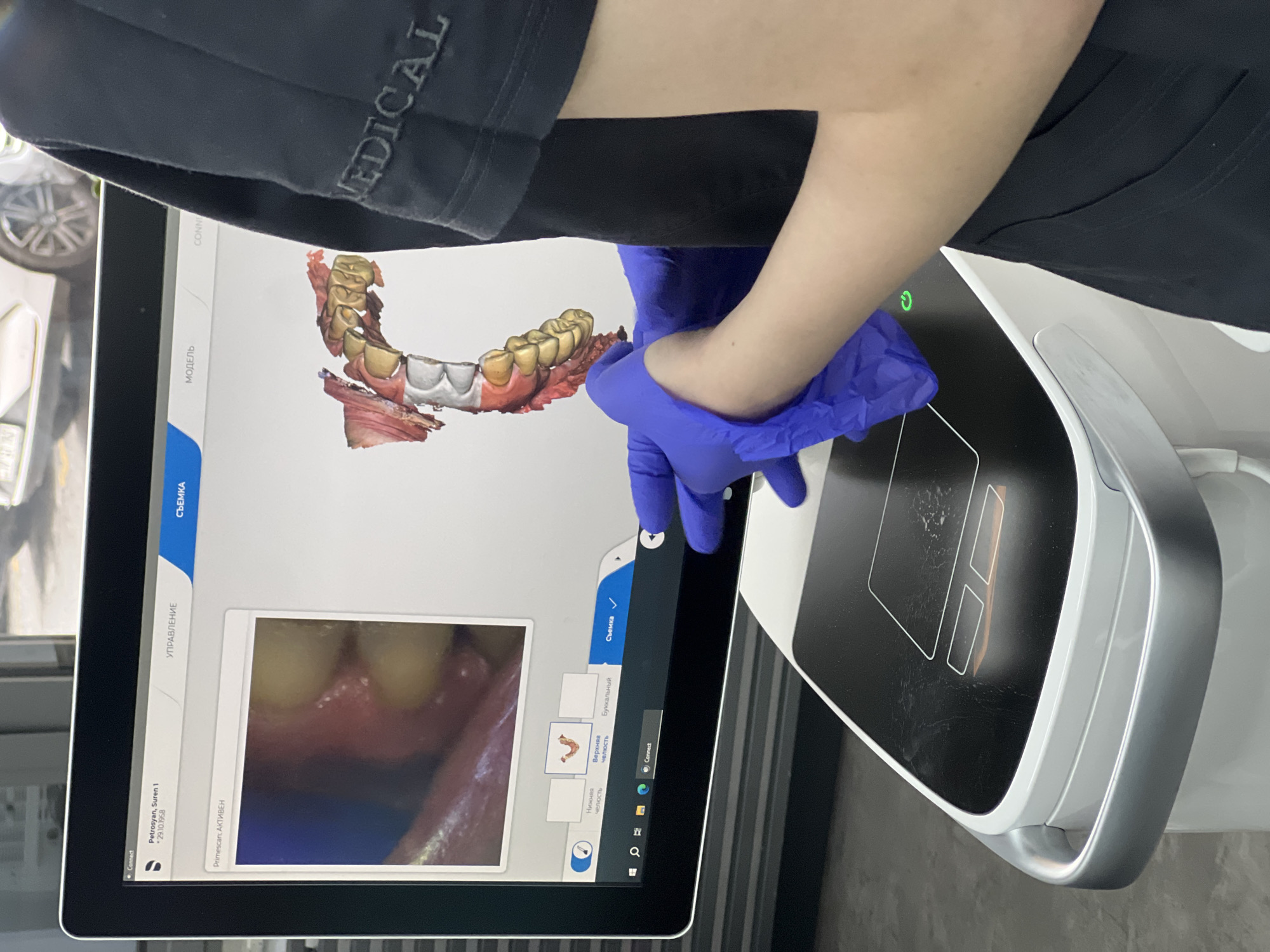 A person wearing blue surgical gloves is interacting with a digital screen displaying a dental scan. The screen shows two distinct images: a 3D model of a set of teeth with exposed gums and a closer view of gums and teeth. The screen also has several labeled functions or buttons. The device has a power button on the top right-hand corner of the screen. The top left-hand corner of the screen indicates that the person logged in is "Petrosyan, Suren 1", and the device being used is a "Primescan". The name "MEDICAL" is visible on the left arm of the individual. The location is Yerevan, Armenia, as indicated by the Cyrillic script on the screen.