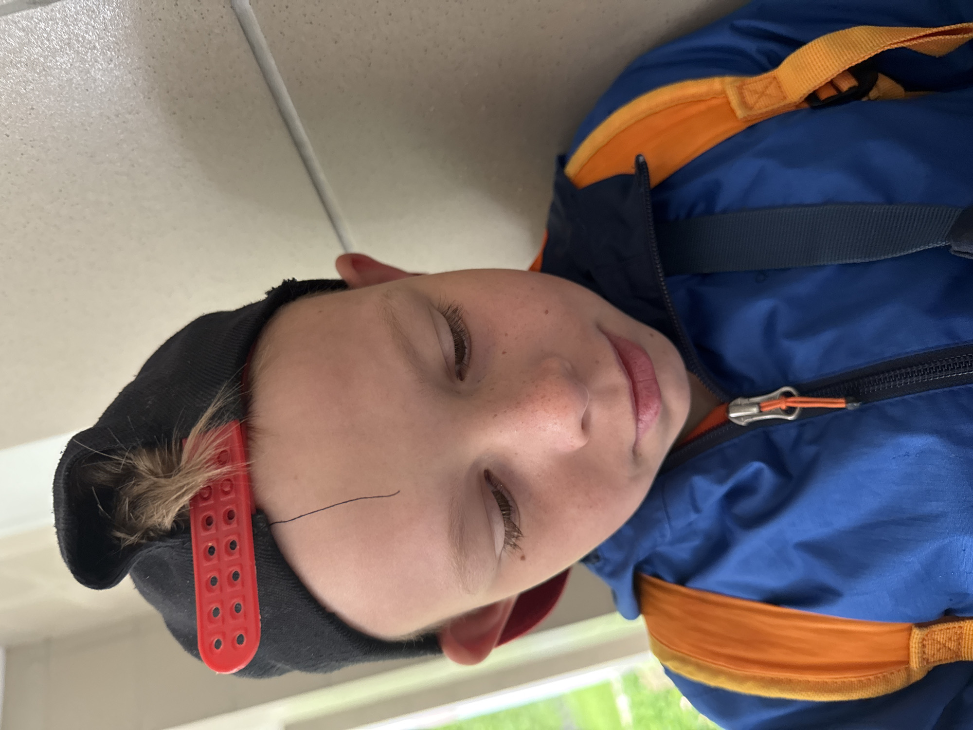 An image, rotated on its side, features a child from the chest up, looking upwards or resting. The child has fair skin, with visible eyelashes framing partially closed eyes, and freckles across the nose and cheeks. A calm expression is present, with lips slightly parted.
The child is wearing a black baseball cap backward, with a bright red plastic snapback adjuster prominent at the back. Strands of light brown hair peek out from beneath the cap. A dark, thin line resembling a strand of hair or a mark is visible on the forehead. The child is dressed in a blue garment, likely a padded jacket or part of a backpack, characterized by vibrant orange straps and accents. A zipper with an orange pull cord is also visible.
The background consists of a light-colored, textured surface, possibly a ceiling or wall, in the upper portion of the frame. A thin white line, possibly a seam or pipe, runs vertically along this surface. In the lower portion, a blurred window reveals green foliage, indicating the scene is set during the daytime, likely indoors. No visible text is present in the image. The location context provided is Chaikovsky, Russia.
