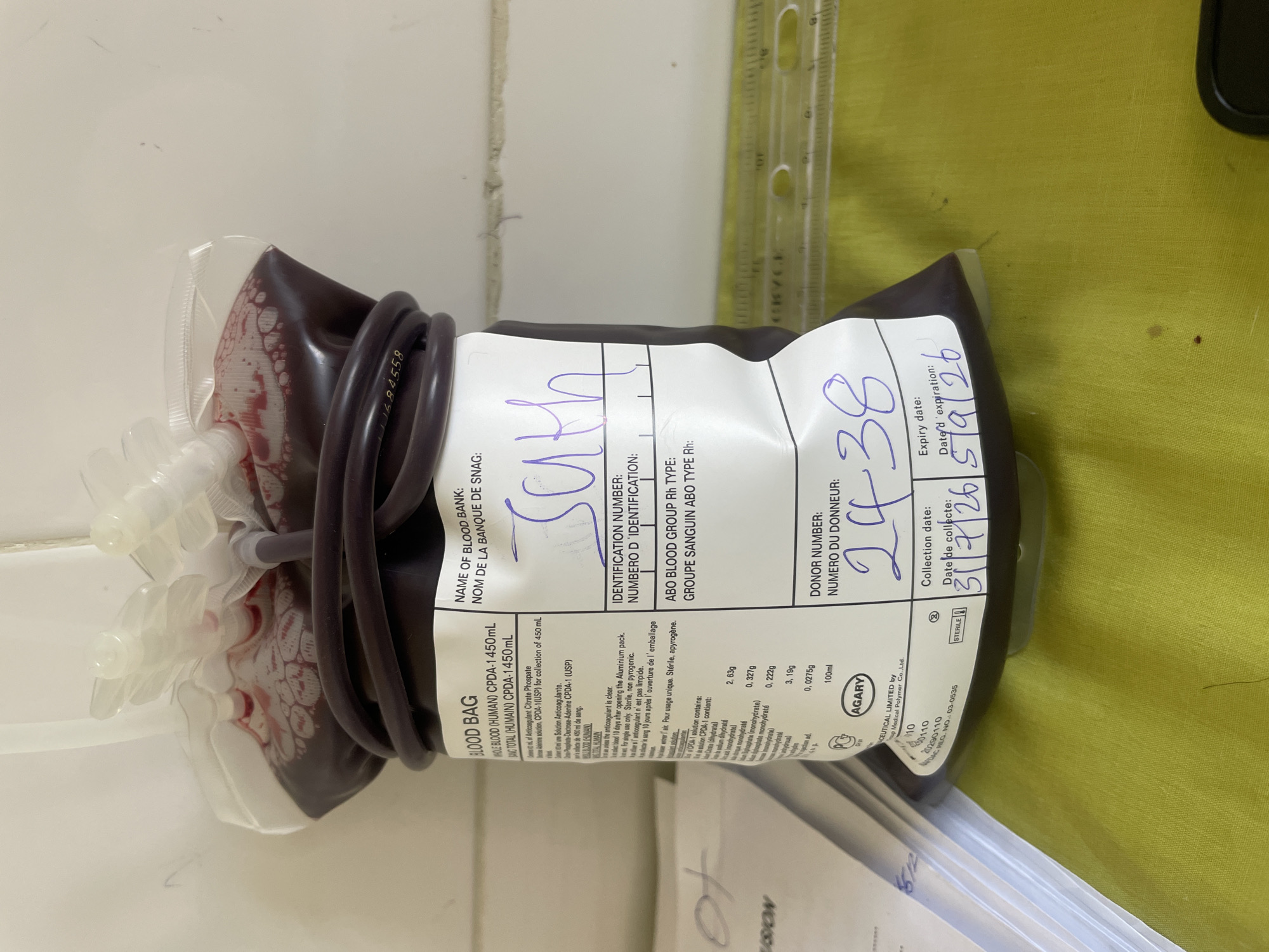 The image shows a blood bag, labeled "BLOOD BAG WHOLE BLOOD (HUMAN) CPDA-1 1450mL". The blood bag contains a dark red liquid. Text on the bag indicates it is from a blood bank and includes fields for identification number, ABO blood group, donor number, collection date, and expiry date. The collection date is recorded as "31/7/26" and the expiry date as "5/9/26". Handwritten markings are present on the bag, including "suth" in purple ink near the top and "24 38" below the donor number field. The blood bag is placed on a yellow surface, with a ruler visible in the background. The surrounding environment appears to be indoors, with a plain, light-colored wall. There is no indication of the city of Gwong, Nigeria in the image or its context.