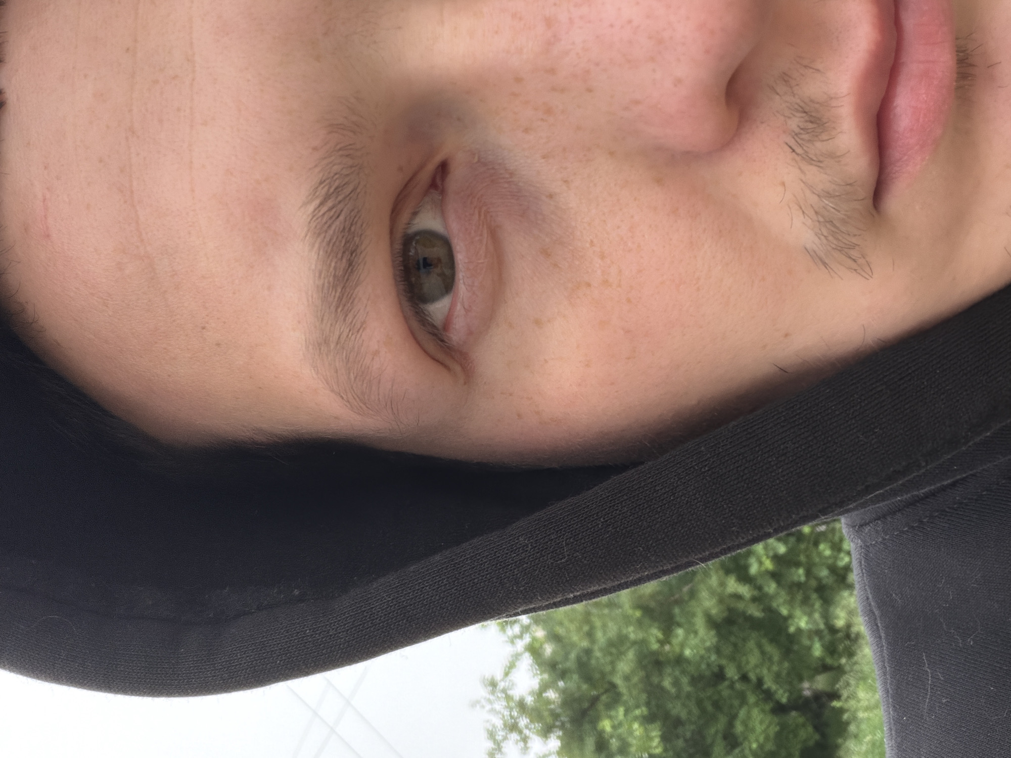 A close-up, rotated 90 degrees clockwise, captures the right side of a person's face, likely an outdoor portrait taken in Chaikovsky, Russia. The individual has fair skin, adorned with numerous light brown freckles visible across their forehead and upper cheek. Their right eye is open, revealing an iris that appears to be light brown or hazel. Fine, light brown eyebrows are present above the eye. Faint stubble or vellus hair can be seen on the cheek, extending towards the sideburn area, and also along the upper lip/philtrum. A minor detail is a small, faint red mark or scratch visible on the upper forehead.
The person is wearing a black hooded garment, which frames the face along the bottom and left edges of the image (when viewed in its original rotated orientation). The texture of the fabric is clearly visible.
In the blurred background, beneath the edge of the hood, are green trees and a bright, overcast or cloudy sky, indicating the photo was taken outdoors during daytime. No specific activity is depicted other than posing for the close-up, possibly a selfie, with a neutral facial expression. There is no visible text in the image.