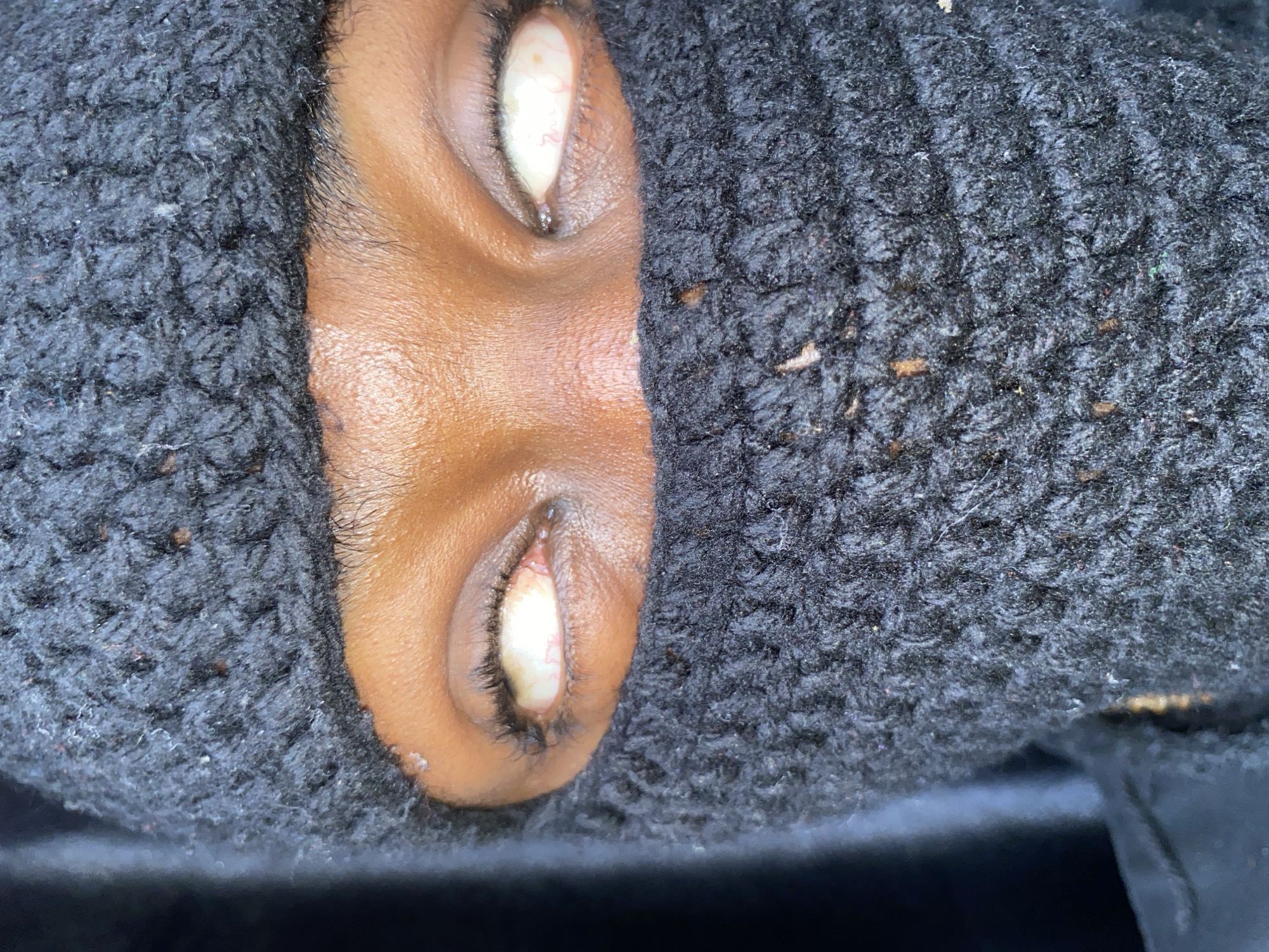 A close-up, distorted view of a person's face peeking out from a dark, knitted fabric, possibly a scarf or balaclava. Only the area between the eyebrows and upper cheek is visible. The skin tone is medium brown. Both eyes are open, showing only the white sclera; no pupils are visible. The eyelashes are dark and sparse. The knitted fabric is black and textured. No further details about location, people, or actions can be determined from the image.