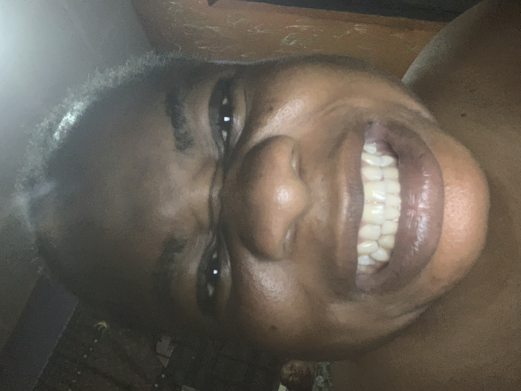 A close-up photograph depicts a person with dark skin and short hair, tilted to the side. Their facial expression includes squinting eyes and a wide smile revealing their teeth. The background is out of focus and provides no discernible contextual clues about the location. The image seems to be indoors.