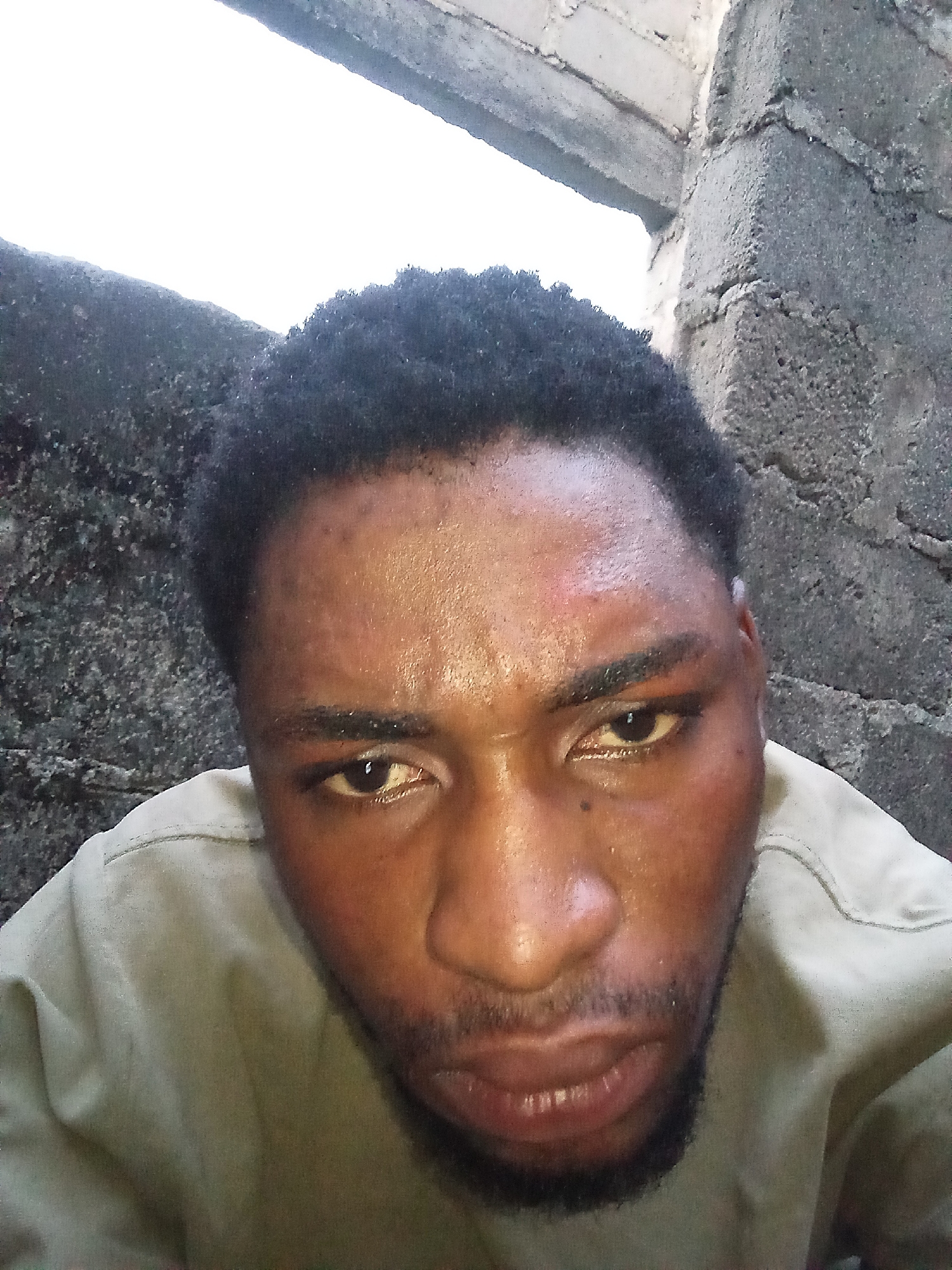 A close-up, selfie-style photograph captures a dark-skinned man's face and upper torso. He is looking directly at the camera with a neutral expression, his mouth slightly open. The man has short, dark, curly hair and a light beard. His forehead appears sweaty and has a reddish mark on the left side. He is wearing a light-colored collared shirt.
The background consists of a rough, grey, concrete wall, suggesting an outdoor or unfinished indoor environment. The lighting is harsh, casting shadows and highlighting the texture of the wall and the man's skin. The photograph appears to have been taken in the city of Lokoja, Nigeria.