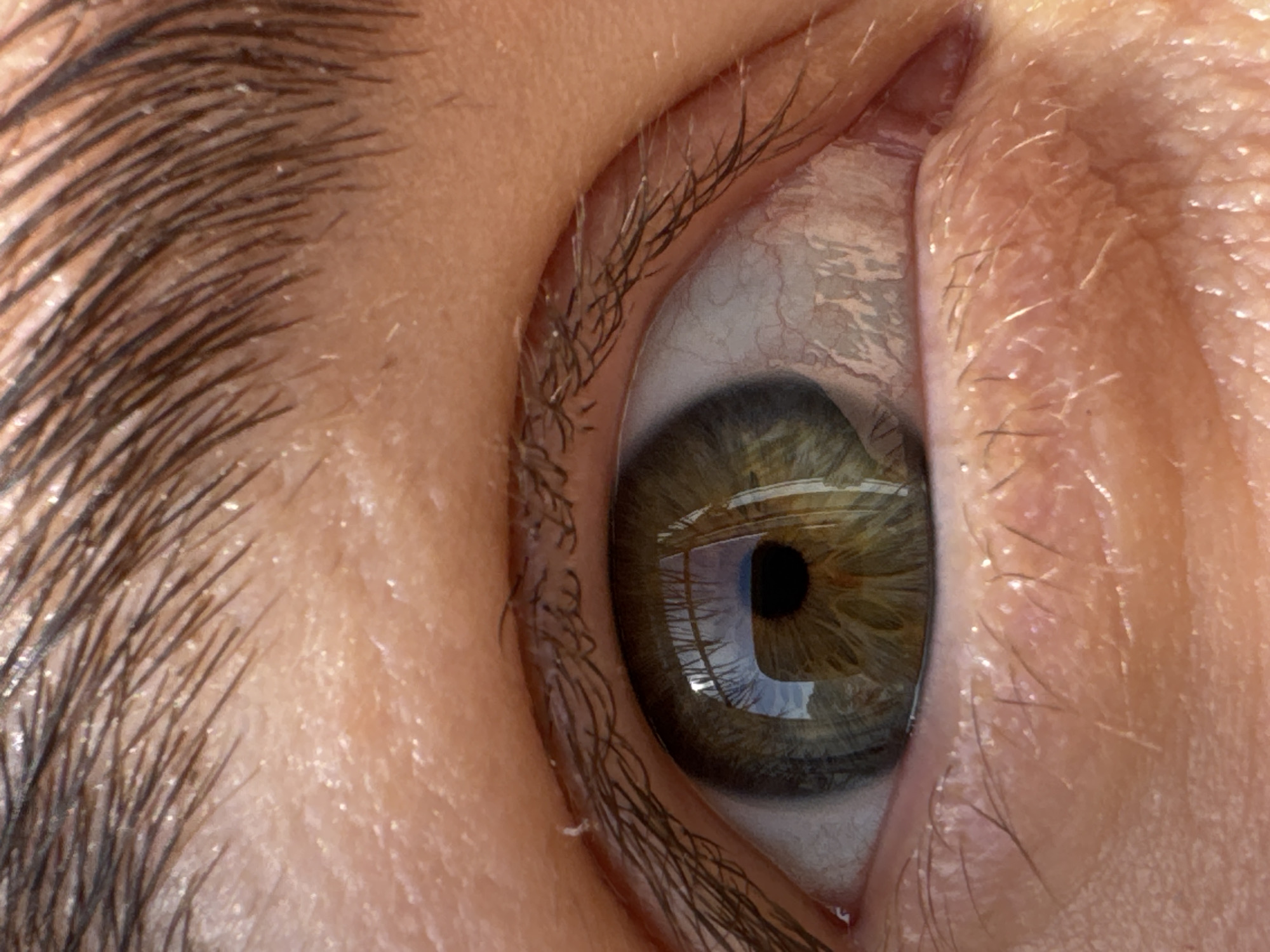 The image presents an extreme close-up of a human right eye, filling the frame. The eye has a hazel or greenish-brown iris with a distinct black pupil. The sclera (white part of the eye) is visible, showing delicate red blood vessels, particularly on the inner side near the tear duct area.
Both the upper and lower eyelids are pulled wide open, revealing the intricate details of the inner eyelid tissue, which appears moist and pink. Dark, fine eyelashes are prominent along both lid margins. Small, white, flaky particles are noticeable among the eyelashes and on the skin of the eyelids, as well as throughout the dense, dark-brown eyebrow that curves into the left side of the frame. The skin around the eye is light-toned, exhibiting fine lines and natural texture.
A clear reflection is visible in the pupil and iris, depicting what appears to be a rectangular window or light source, possibly with horizontal panes or blinds, suggesting an indoor setting with good illumination. The reflection indicates bright, direct light hitting the eye.
The scene focuses solely on the eye and its immediate surroundings, highlighting biological textures and minor superficial details. There is no visible text. The overall impression is one of intense magnification, revealing features not typically seen by the naked eye from a normal viewing distance.