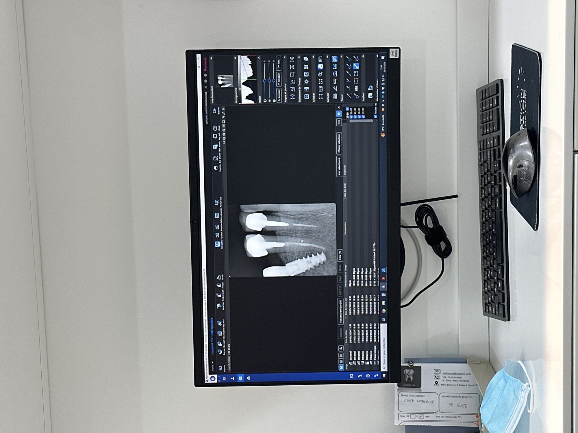 The image captures a dental office setting, featuring a computer screen displaying a dental X-ray of a patient's teeth with an implant. The software interface on the screen shows various dental imaging tools and patient data.
To the right of the screen, a keyboard and mouse are positioned on the desk. Below the screen, there is a patient information form with details such as the patient's name (GUEZ CATHERINE) and the practitioner's name (DR GUEZ). A blue surgical mask is also present on the desk.
Based on the contact information on the patient form ("44Bis Boulevard Richard Lenoir 75"), the location is inferred to be in Paris, France, specifically on or near Boulevard Richard Lenoir.