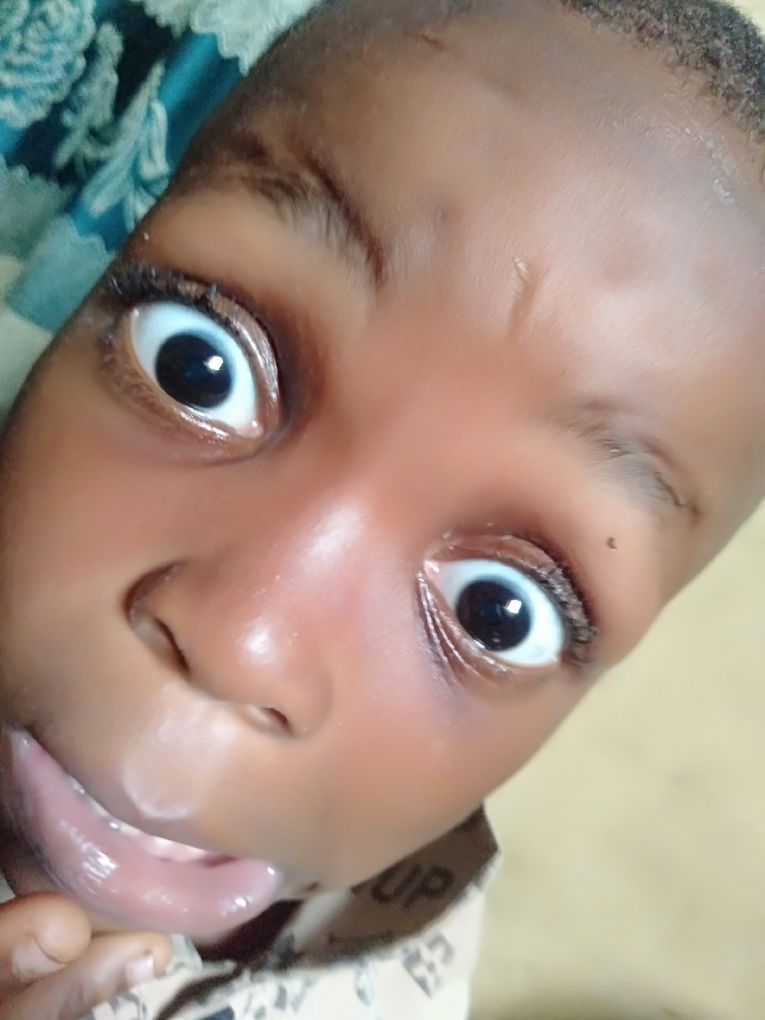A close-up shot from a low angle shows the face of a young dark-skinned child. The child's eyes are wide open and directed upwards, with clear whites and black pupils. The child's skin appears smooth and slightly shiny. A small scratch is visible on the forehead. The lips are parted slightly. The setting appears to be indoors, possibly a residential environment. The location is Shangisha, Nigeria, but the image does not contain visual markers to confirm this.